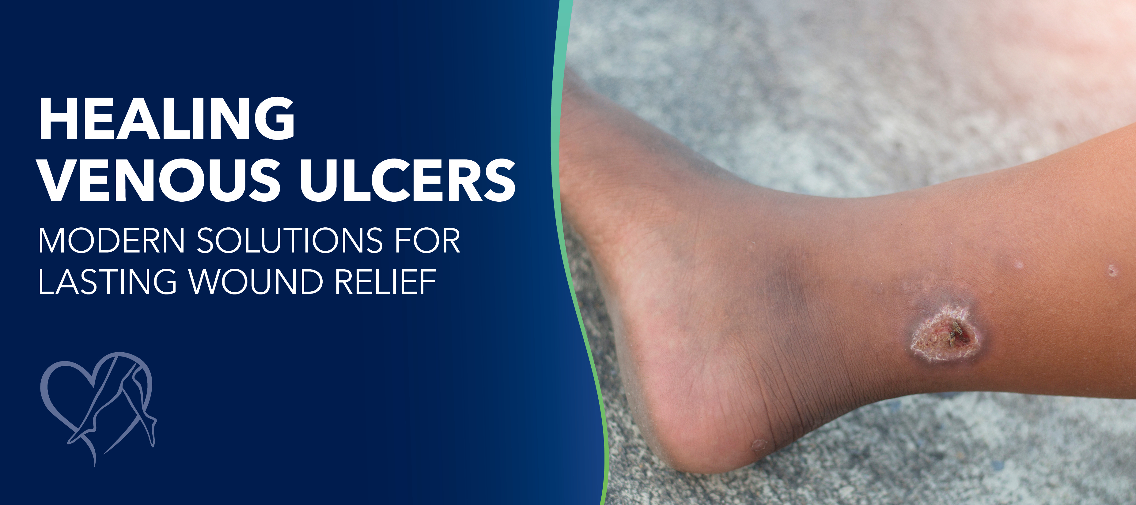 Blog Healing Venous Ulcers
