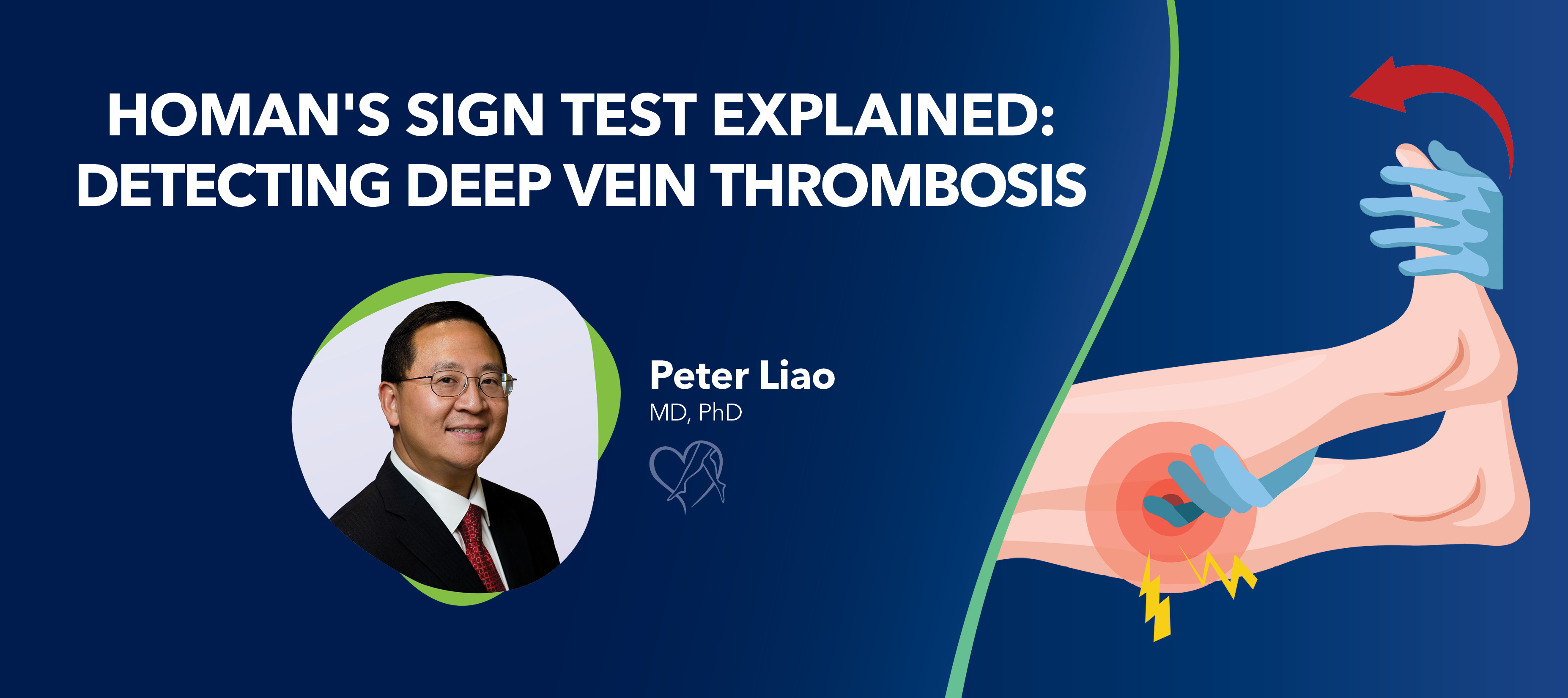 Blog Homans Sign Test Explained