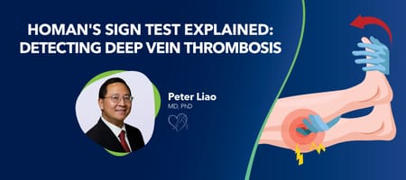 Negative Homans Homan’s Sign Test Explained: Detecting Deep Vein Thrombosis