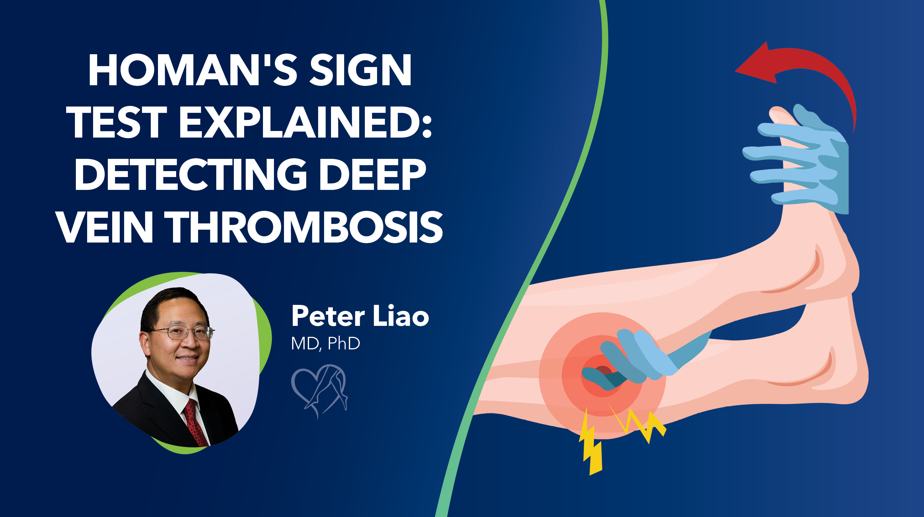 Blog Homans Sign Test Explained Thumbnail