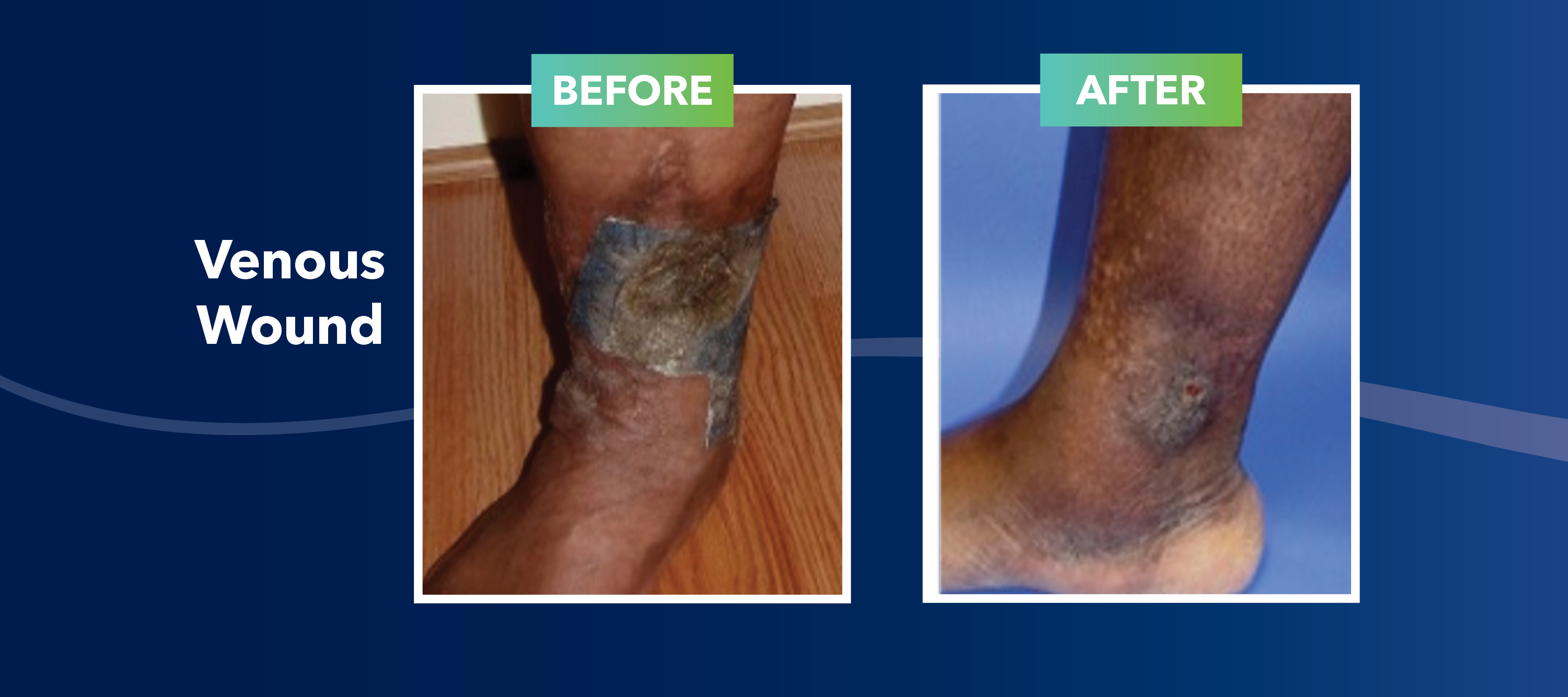 How to Tell the Difference Between Types of Leg Wounds