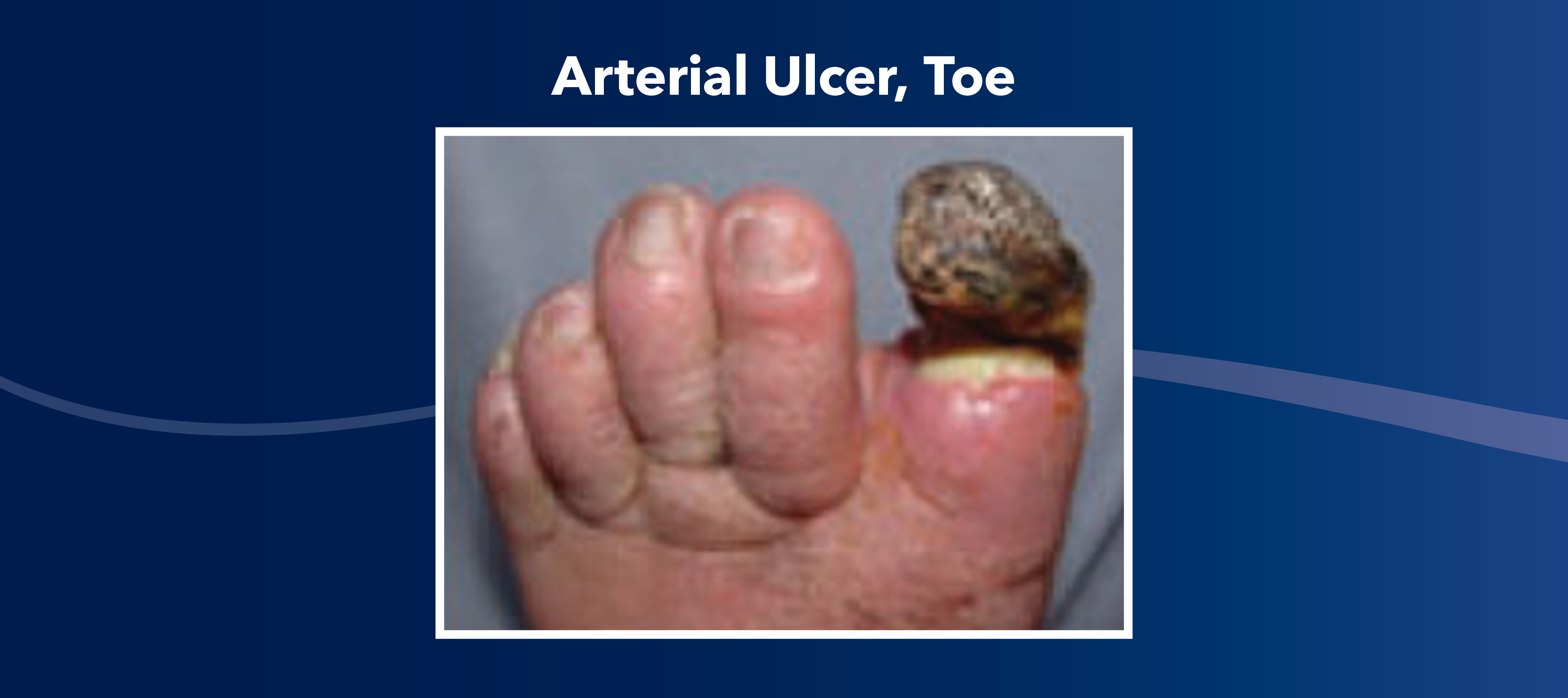 Blog How to Tell the Difference Between Types of Leg Wounds Blog Slider3