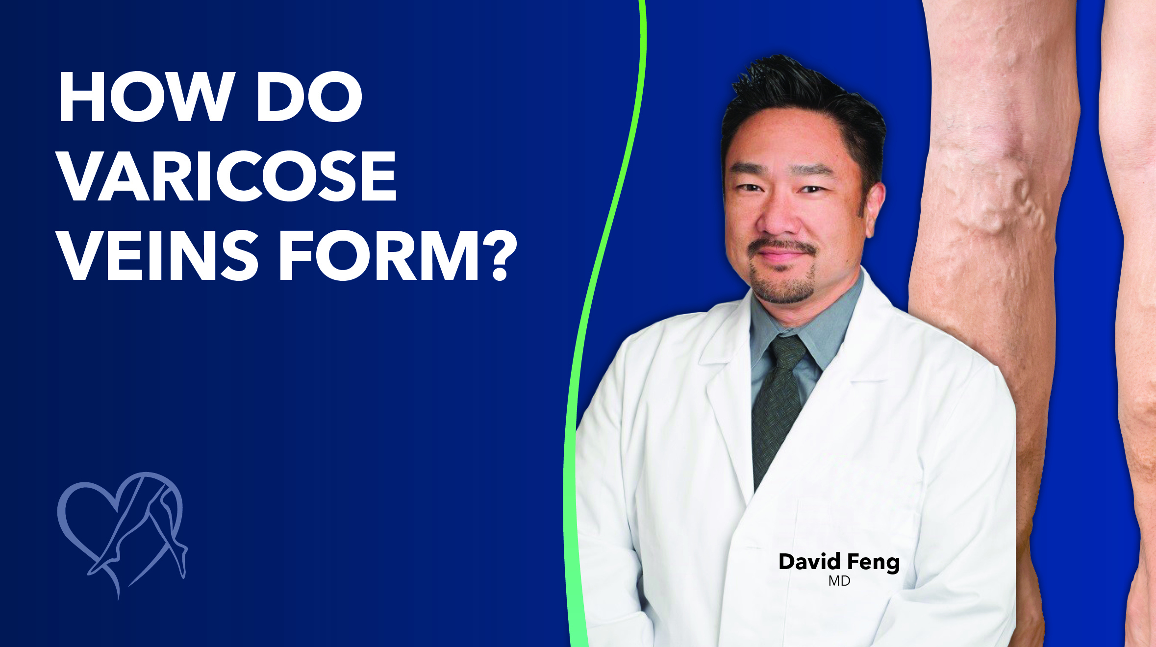 Blog How Do Varicose Veins Form Dr Feng Thumbnail