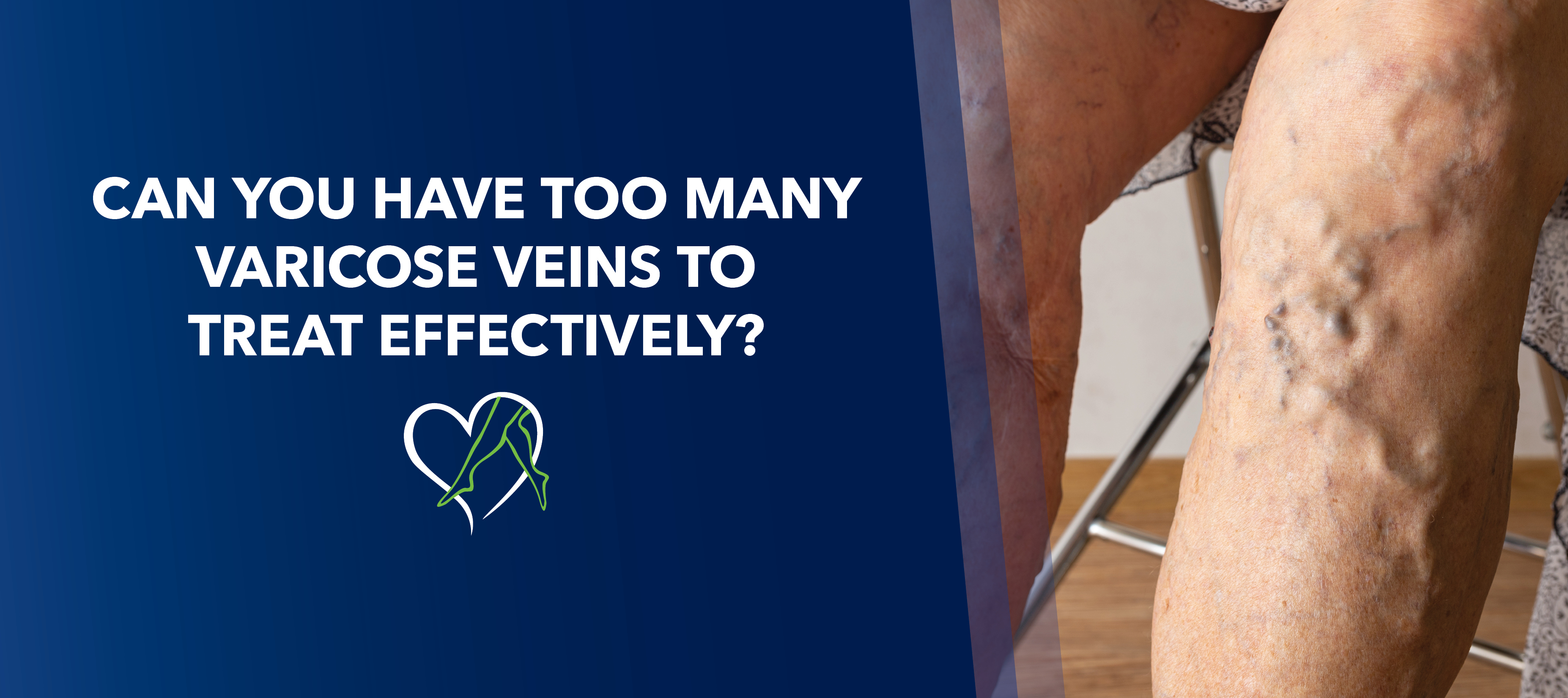 Blog Is It Possible Too Many Veins