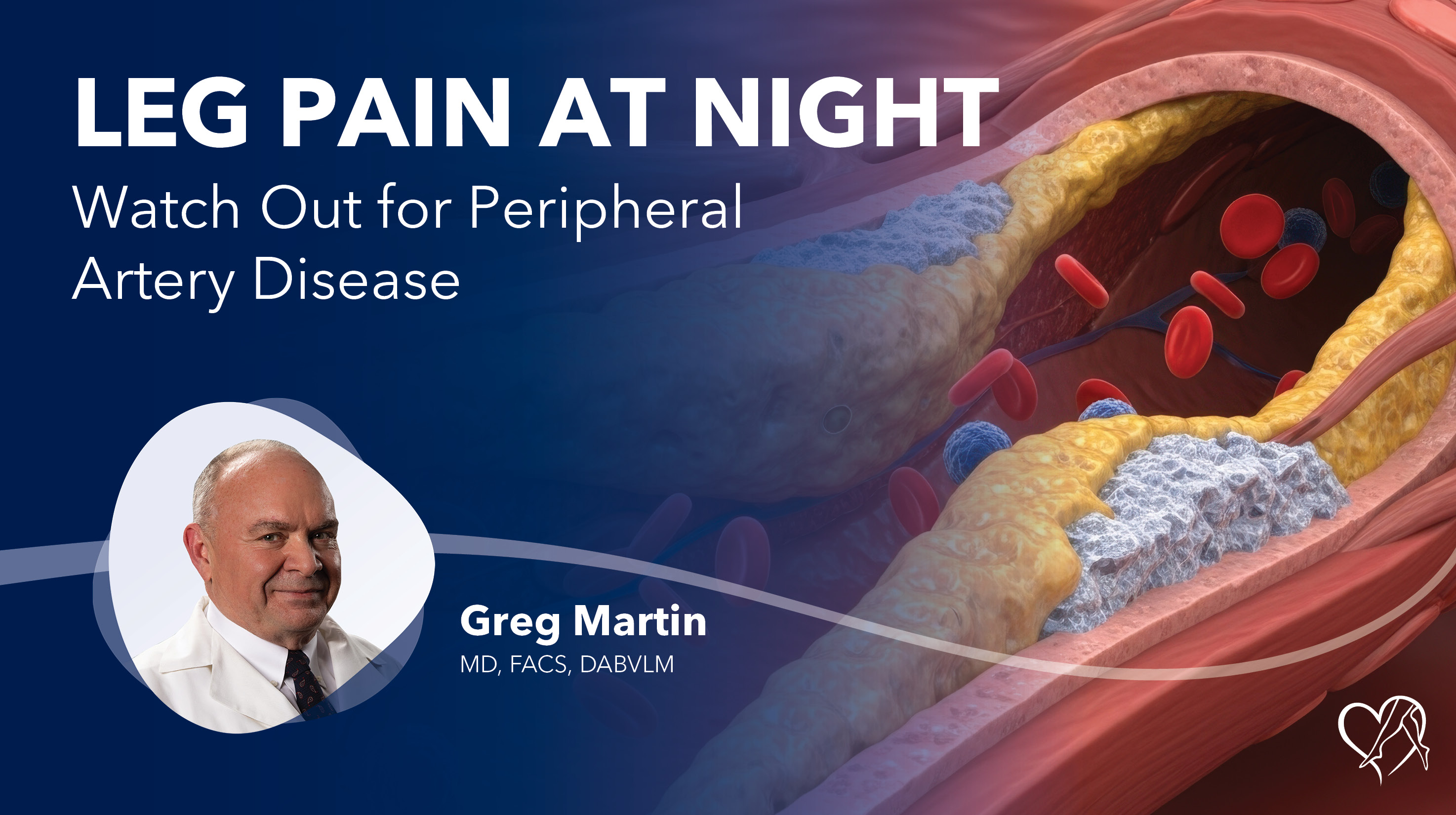 Blog Leg Pain At Night Thumbnail