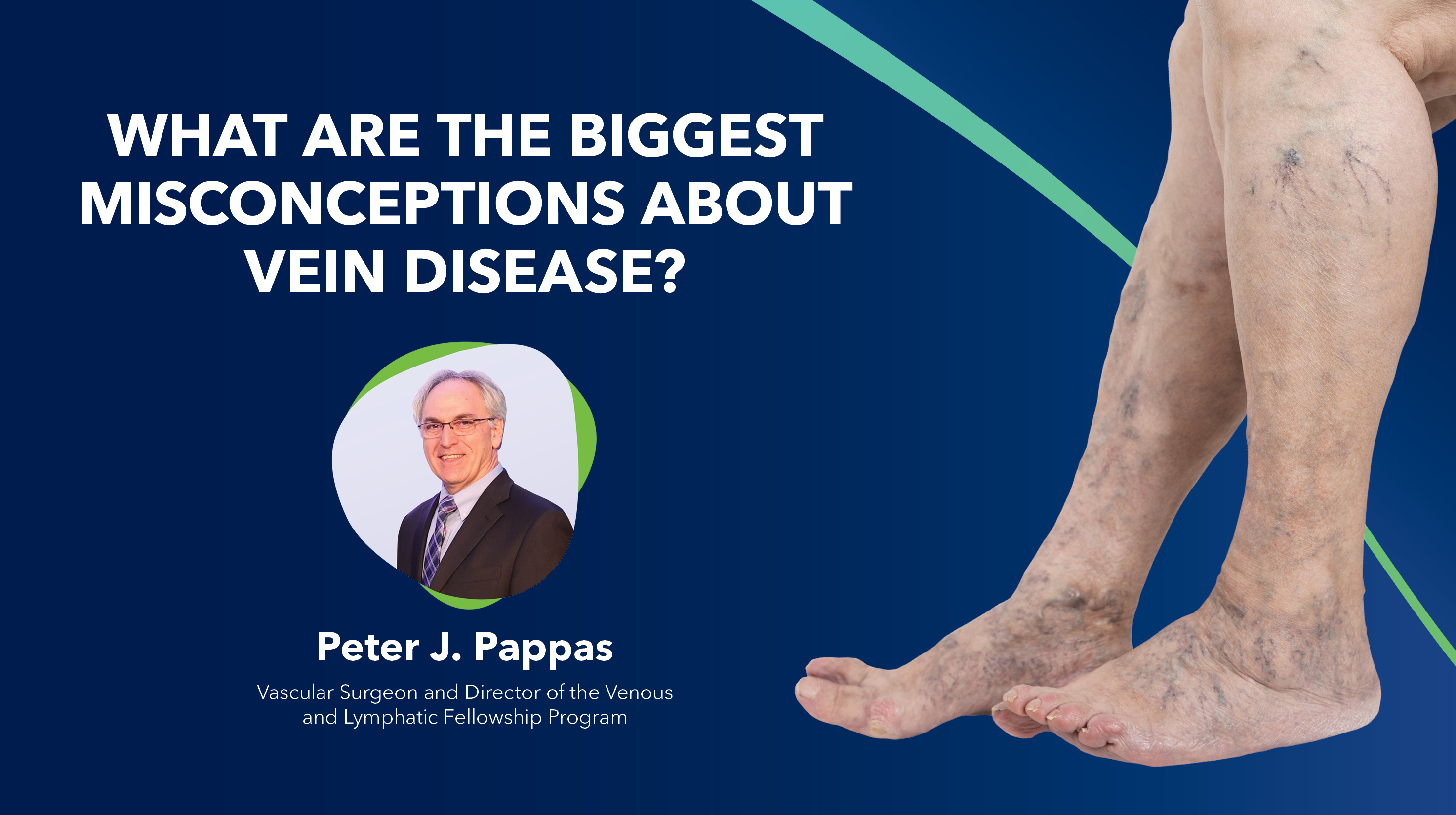 Blog Misconceptions About Vein Disease Thumbnail
