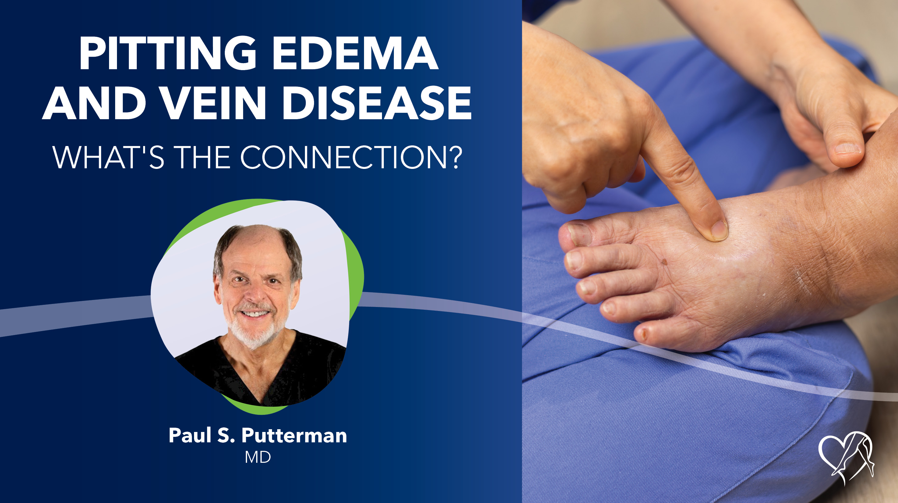 Blog Pitting Edema 2026 Thumbnail