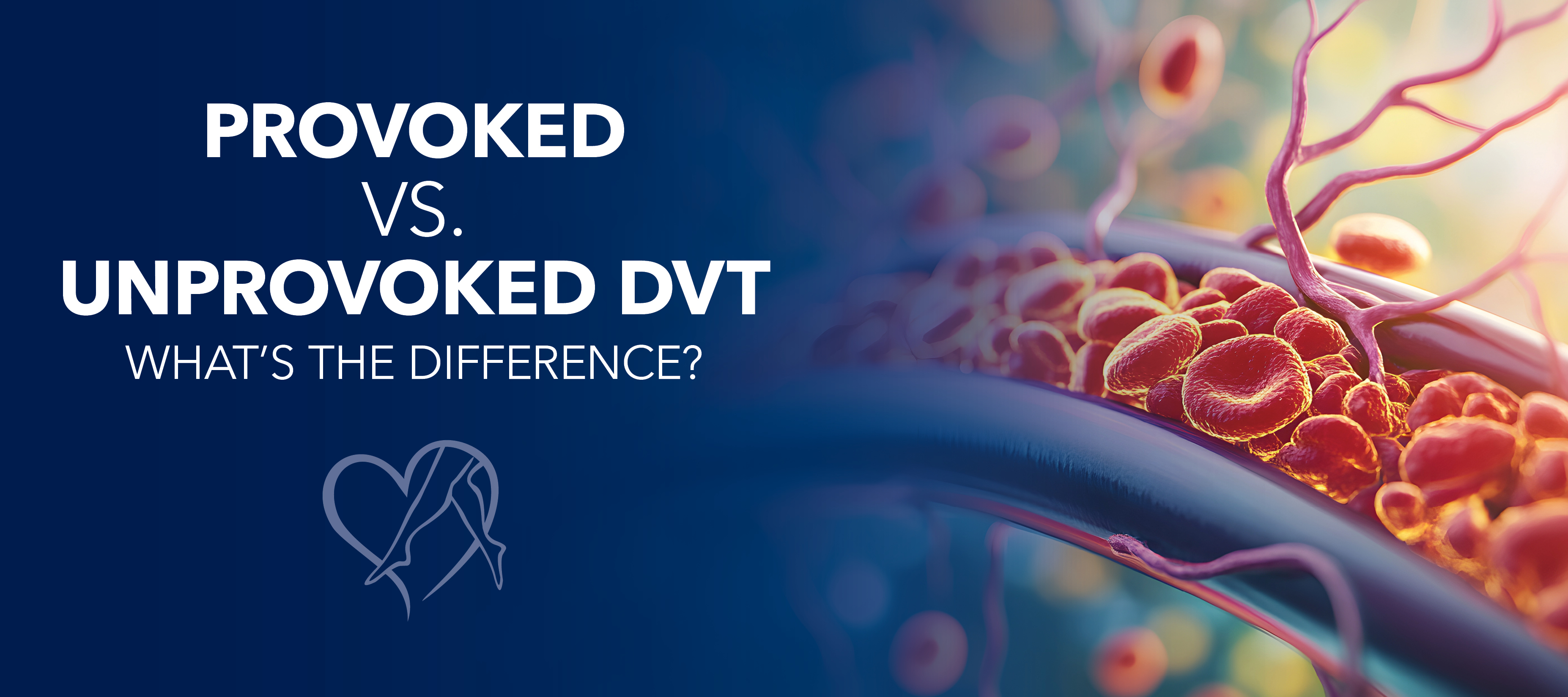 Blog Provoked VS Unprovoked DVT