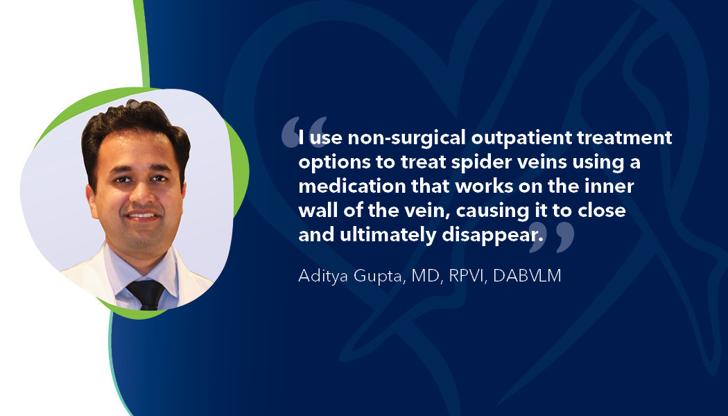 Blog Quote Dr Gupta How To Treat Spider Veins 041423