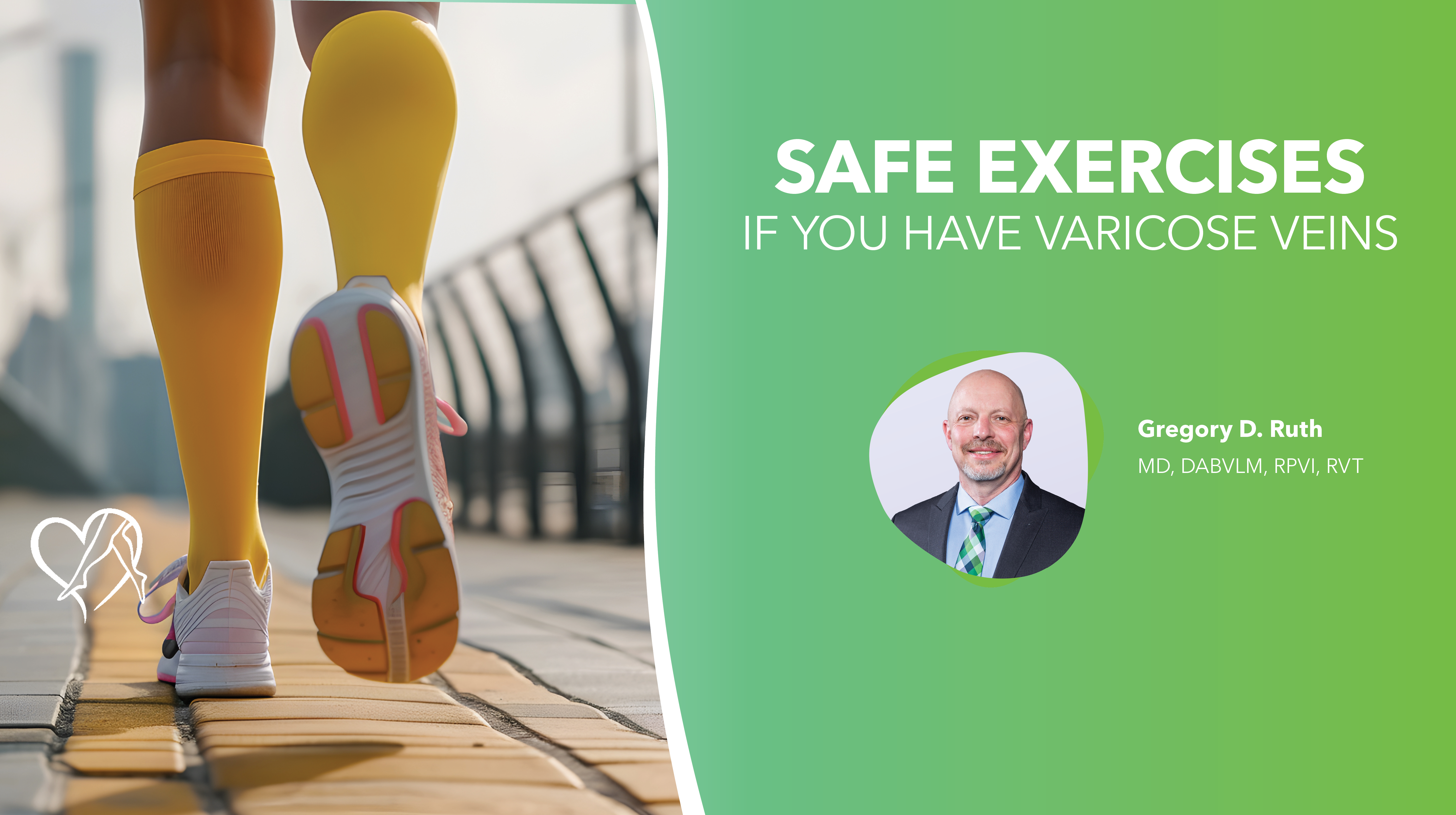 Blog Safe Exercise If You Have Varicose Veins thumbnail
