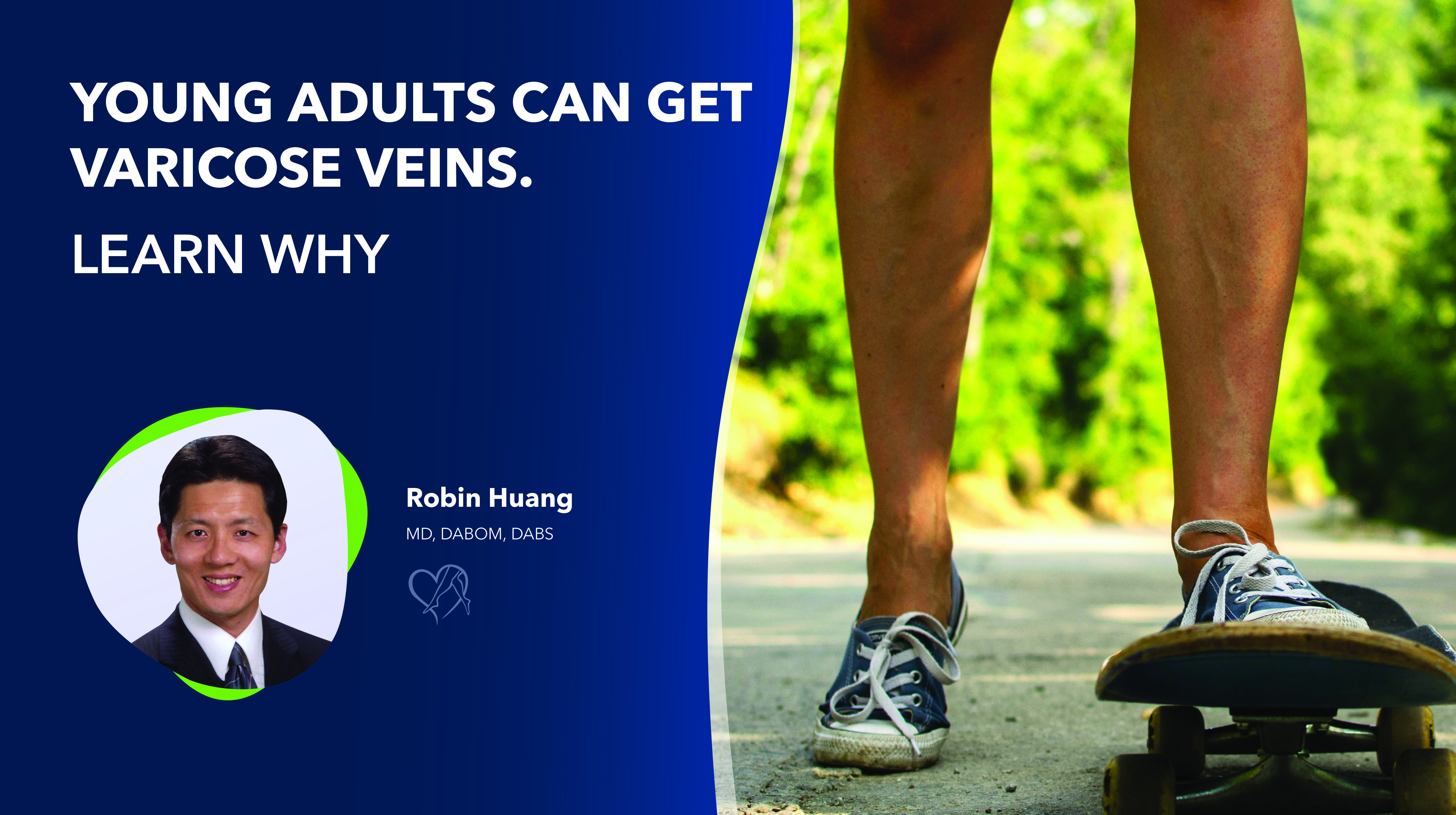 Blog Thumbnail Image Young Adults Can Get Varicose Veins Thumbnail