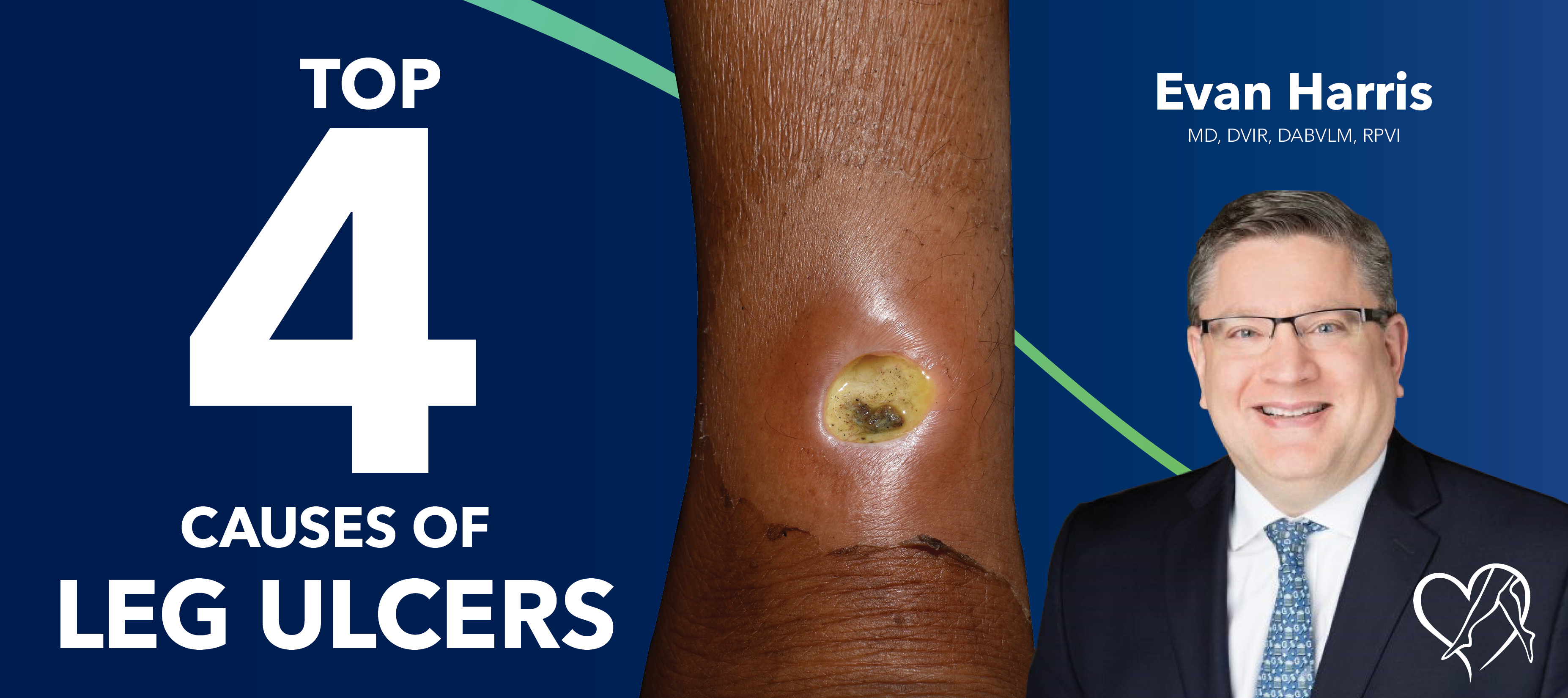 Blog Top4 Causes Of Leg Ulcers