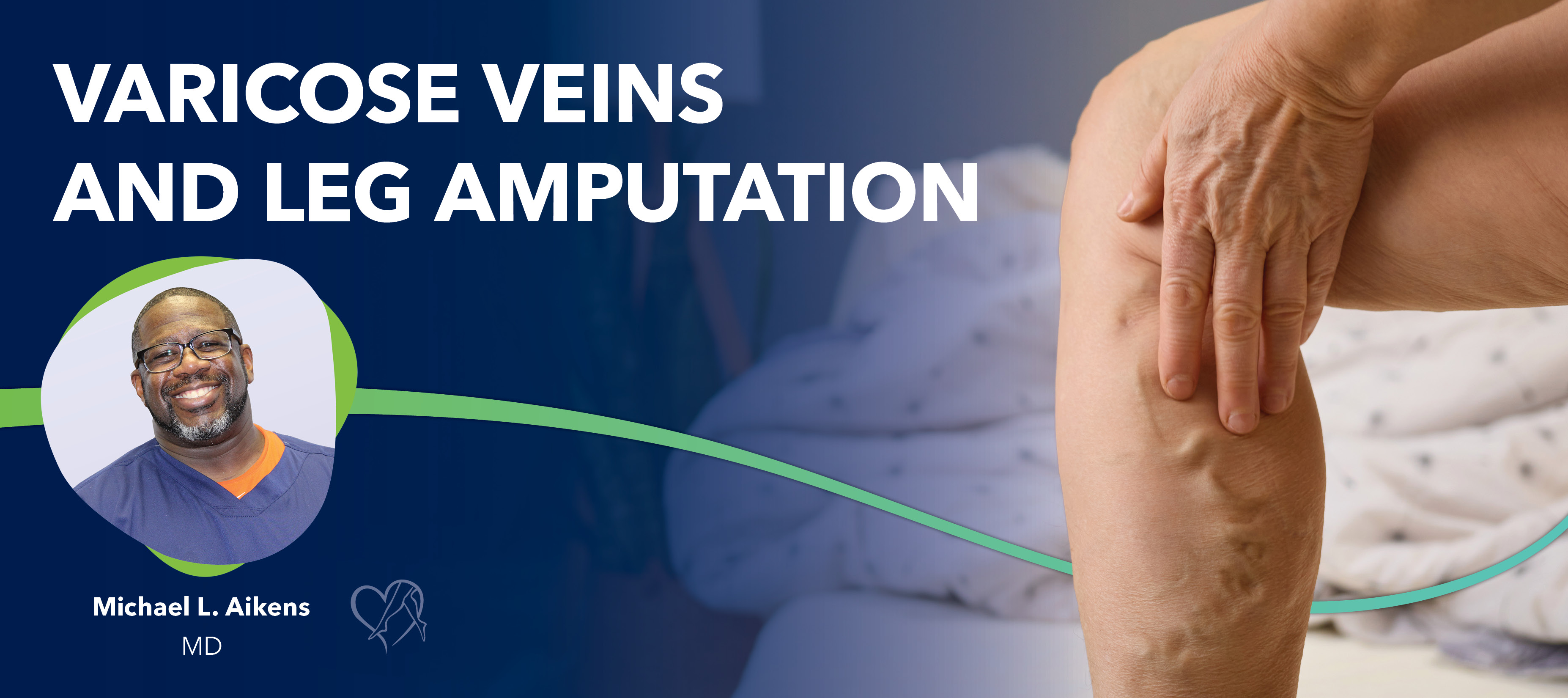 Blog Varicose Veins And Amputation