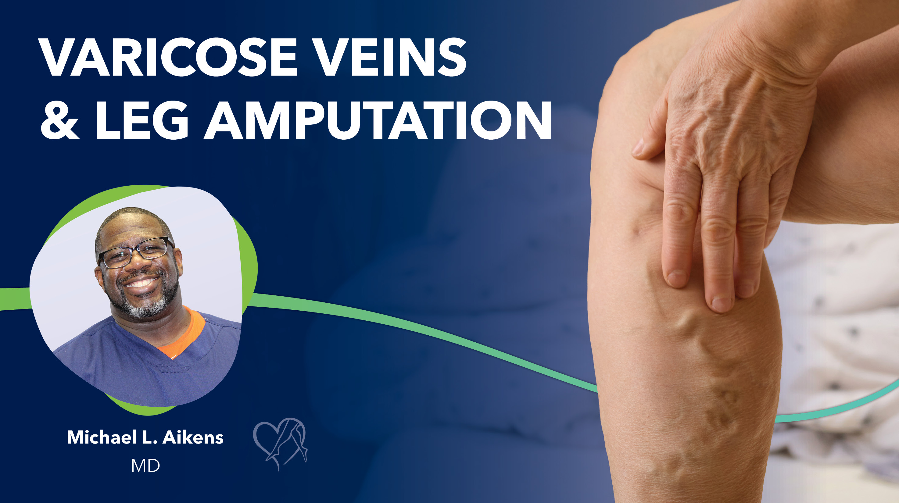 Blog Varicose Veins And Amputation Thumbnail