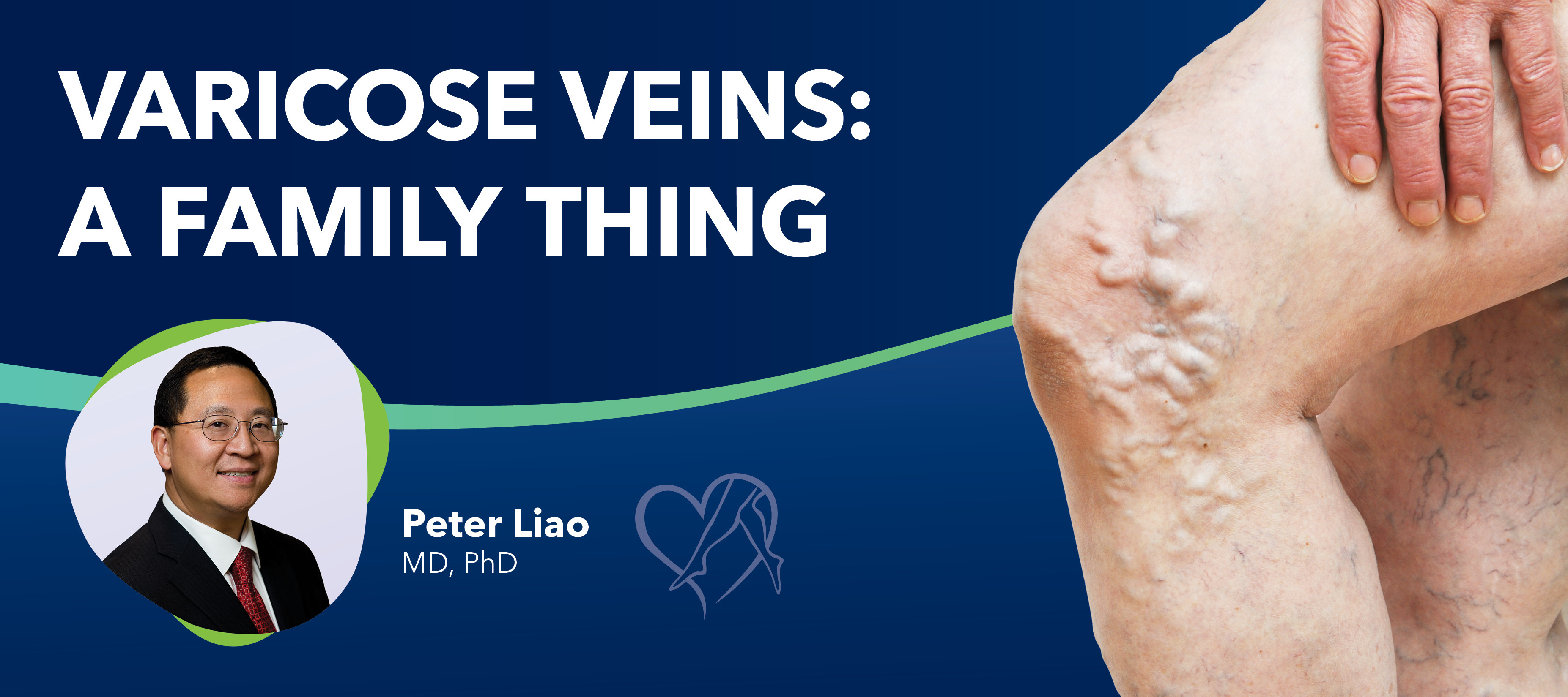 Blog Varicose Veins Family Thing