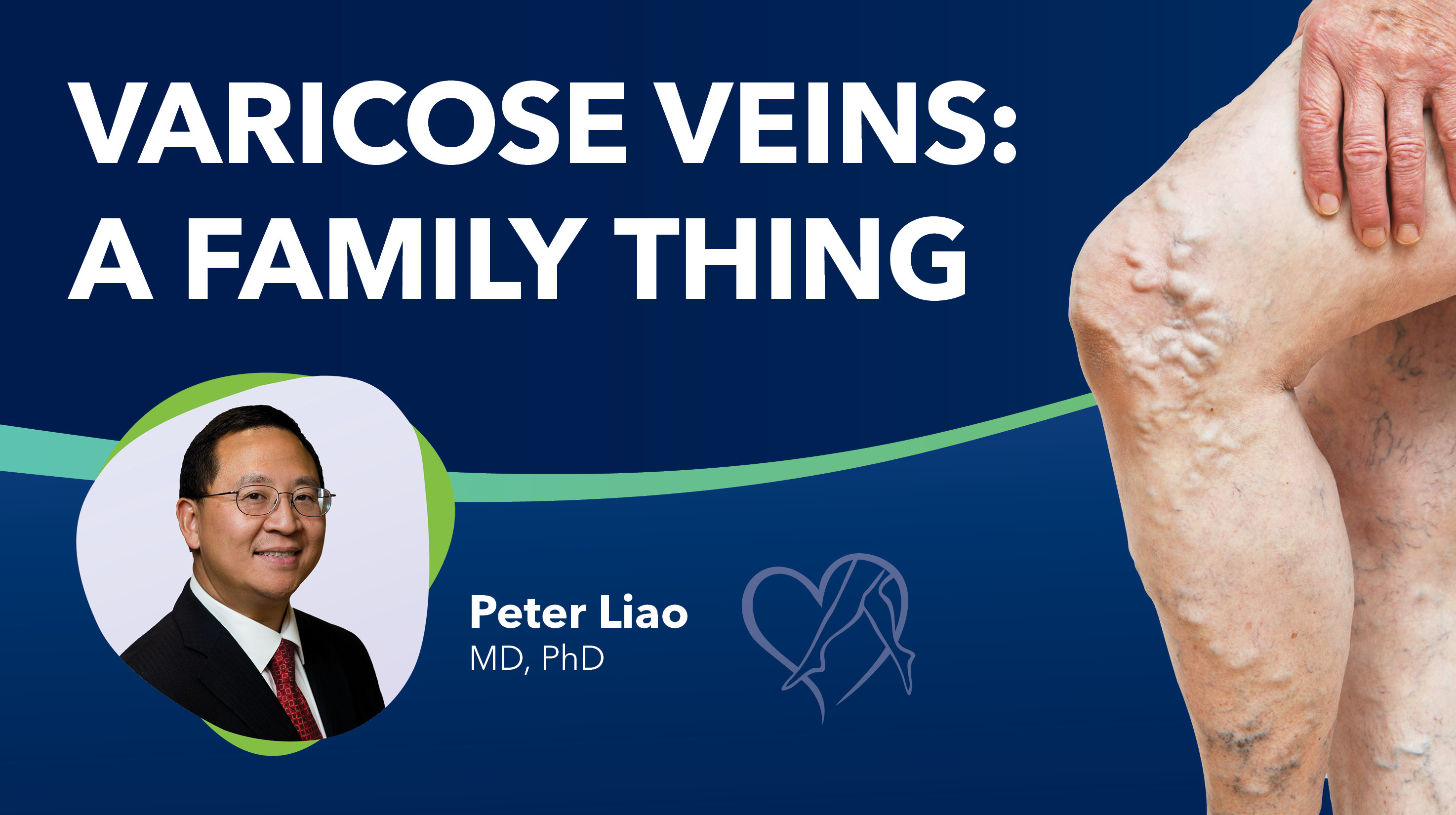 Blog Varicose Veins Family Thing Thumbnail