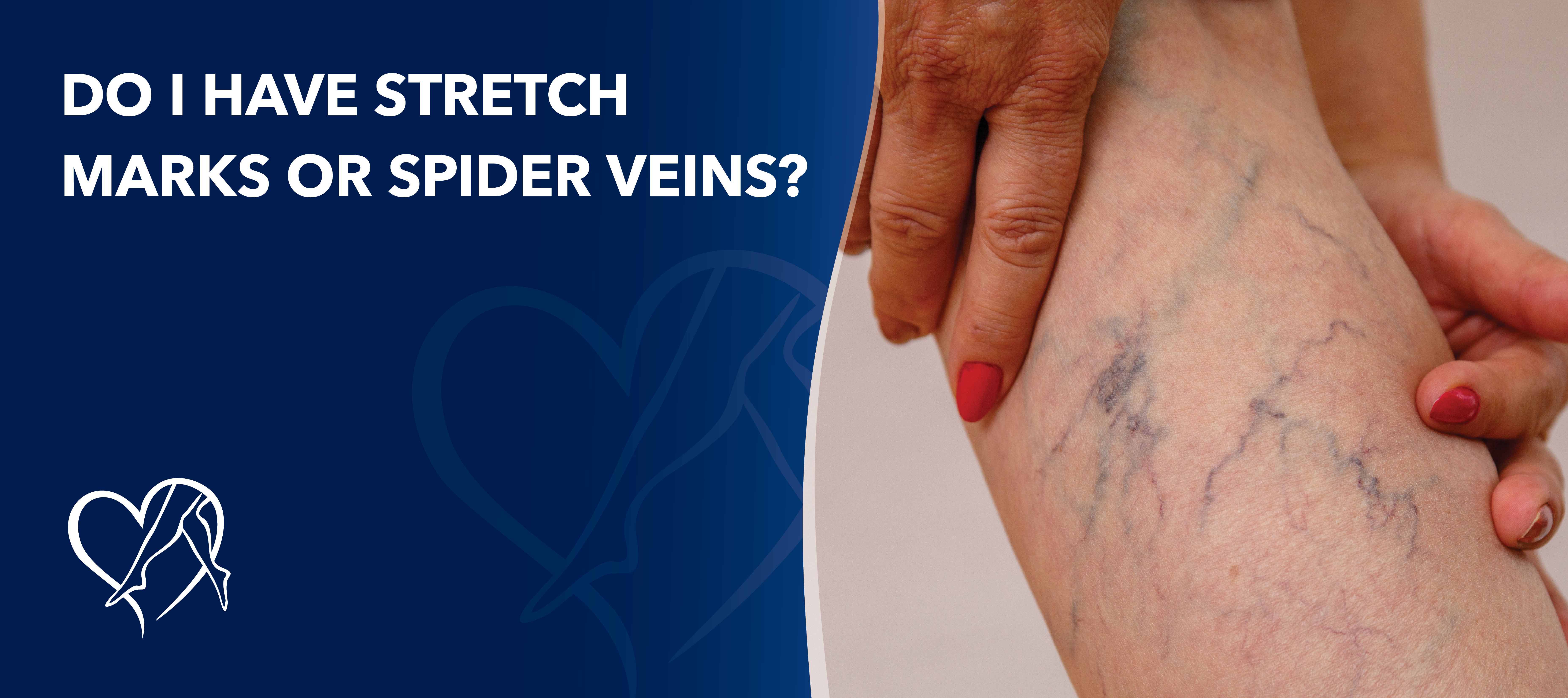 Blog What Does Skin Discoloration on My Legs Mean