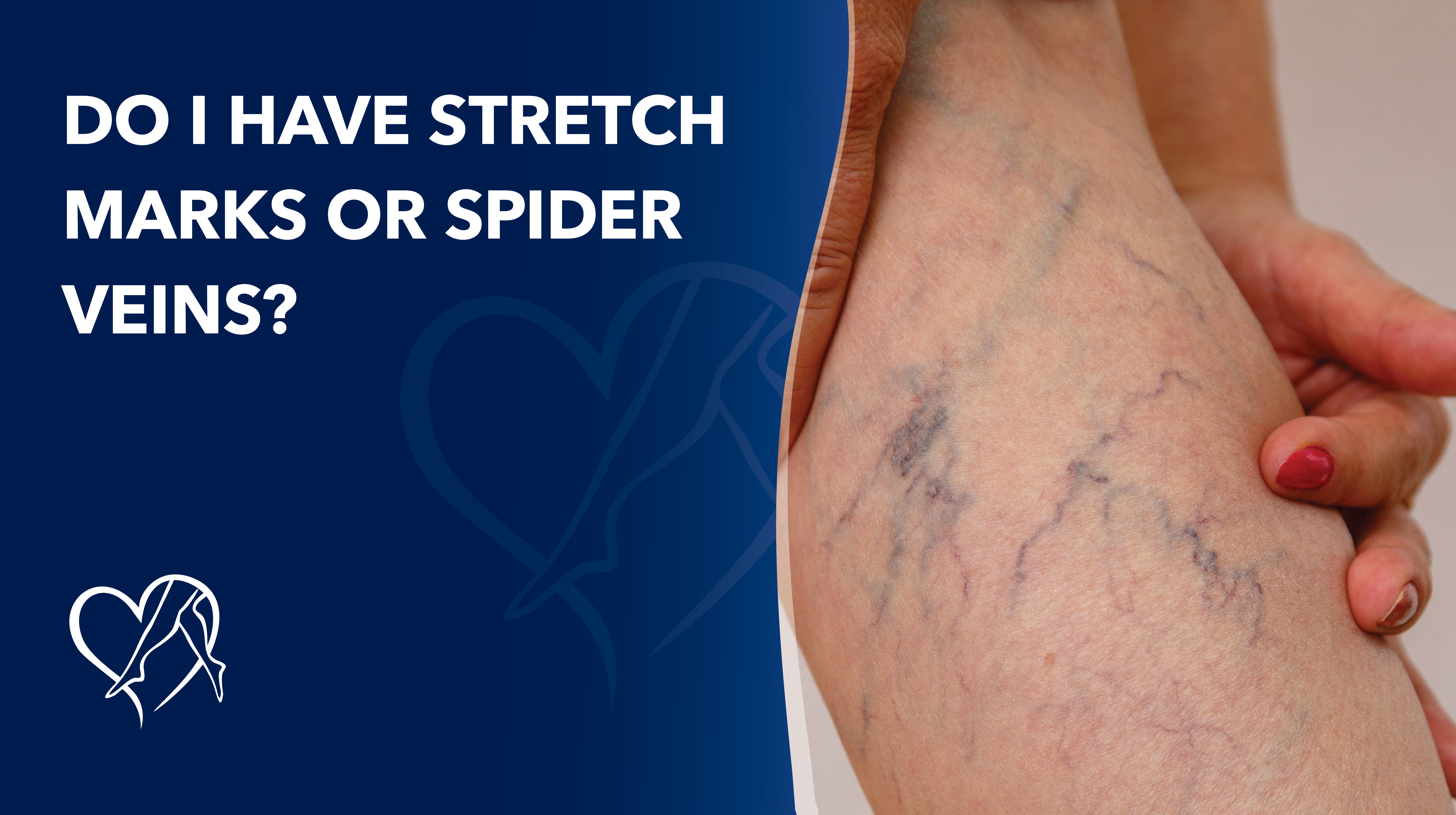 Blog What Does Skin Discoloration on My Legs Mean thumbnail