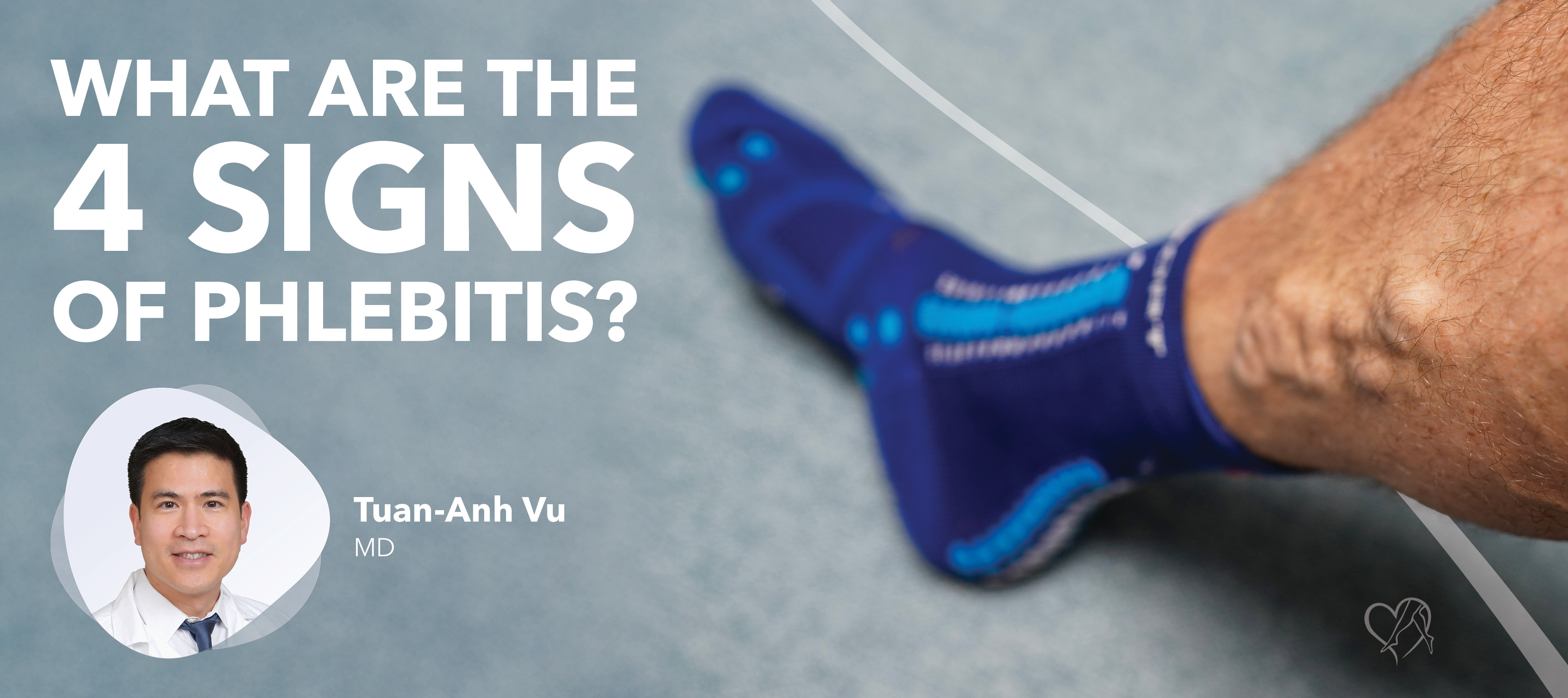 Blog What Are The4 Signs Of Phlebitis