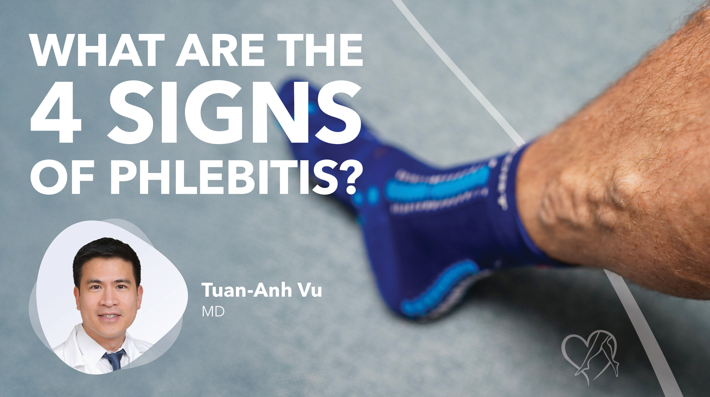 Blog What Are The4 Signs Of Phlebitis Thumbnail