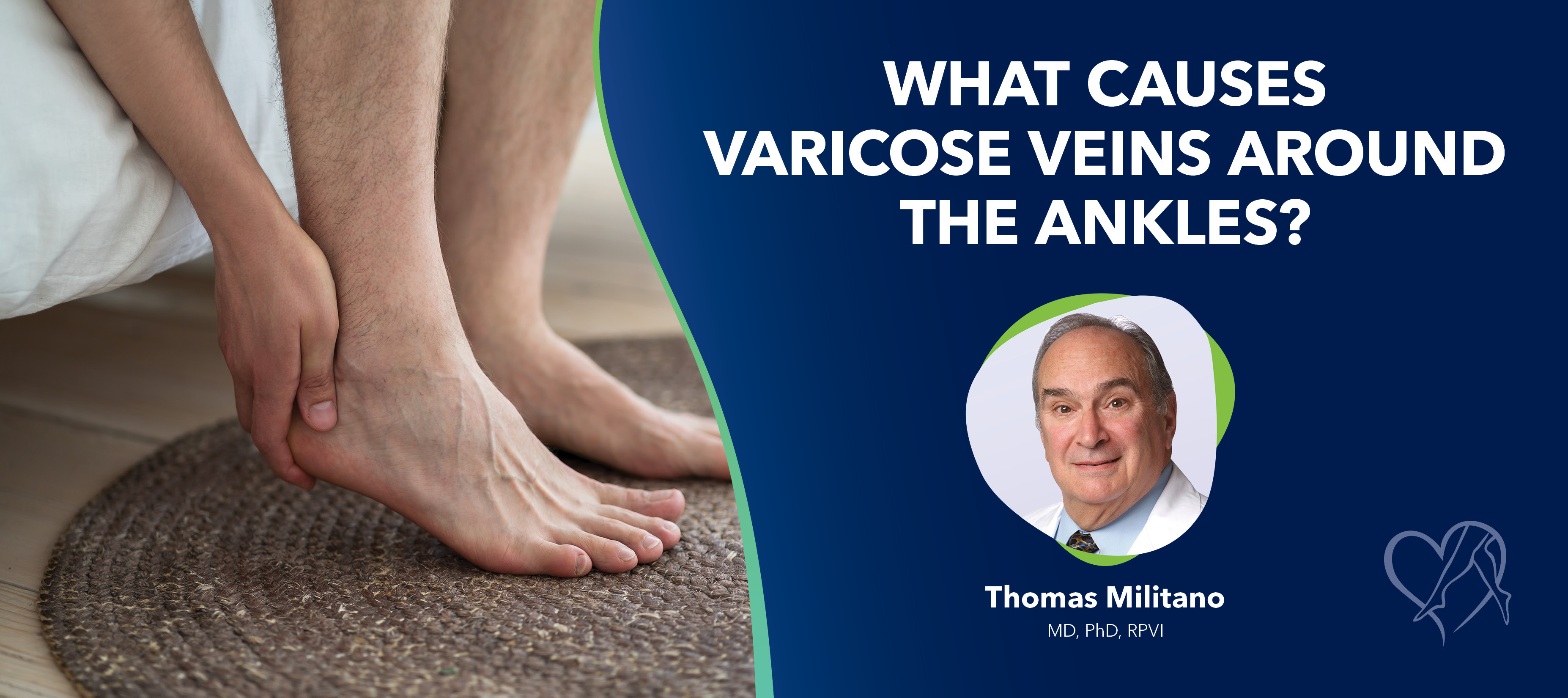 Blog What Causes Varicose Veins Aroundthe Ankles