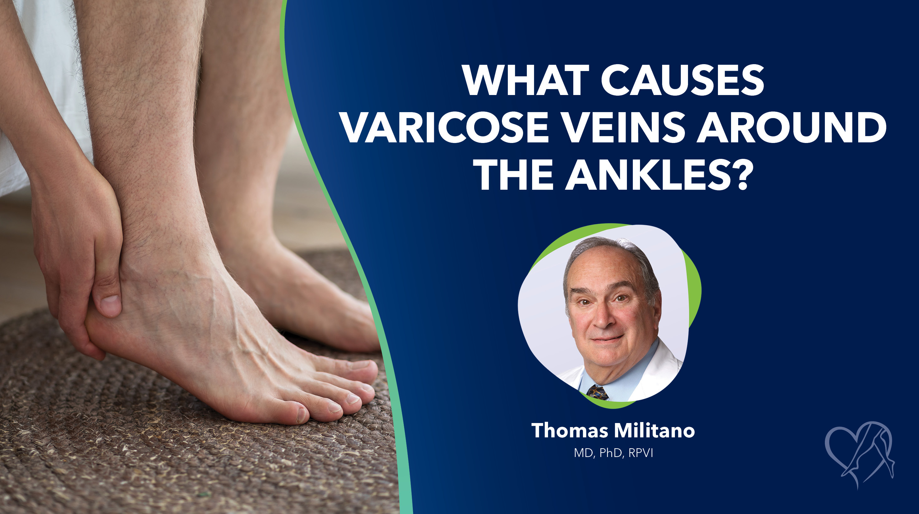 Blog What Causes Varicose Veins Aroundthe Ankles Thumbnail