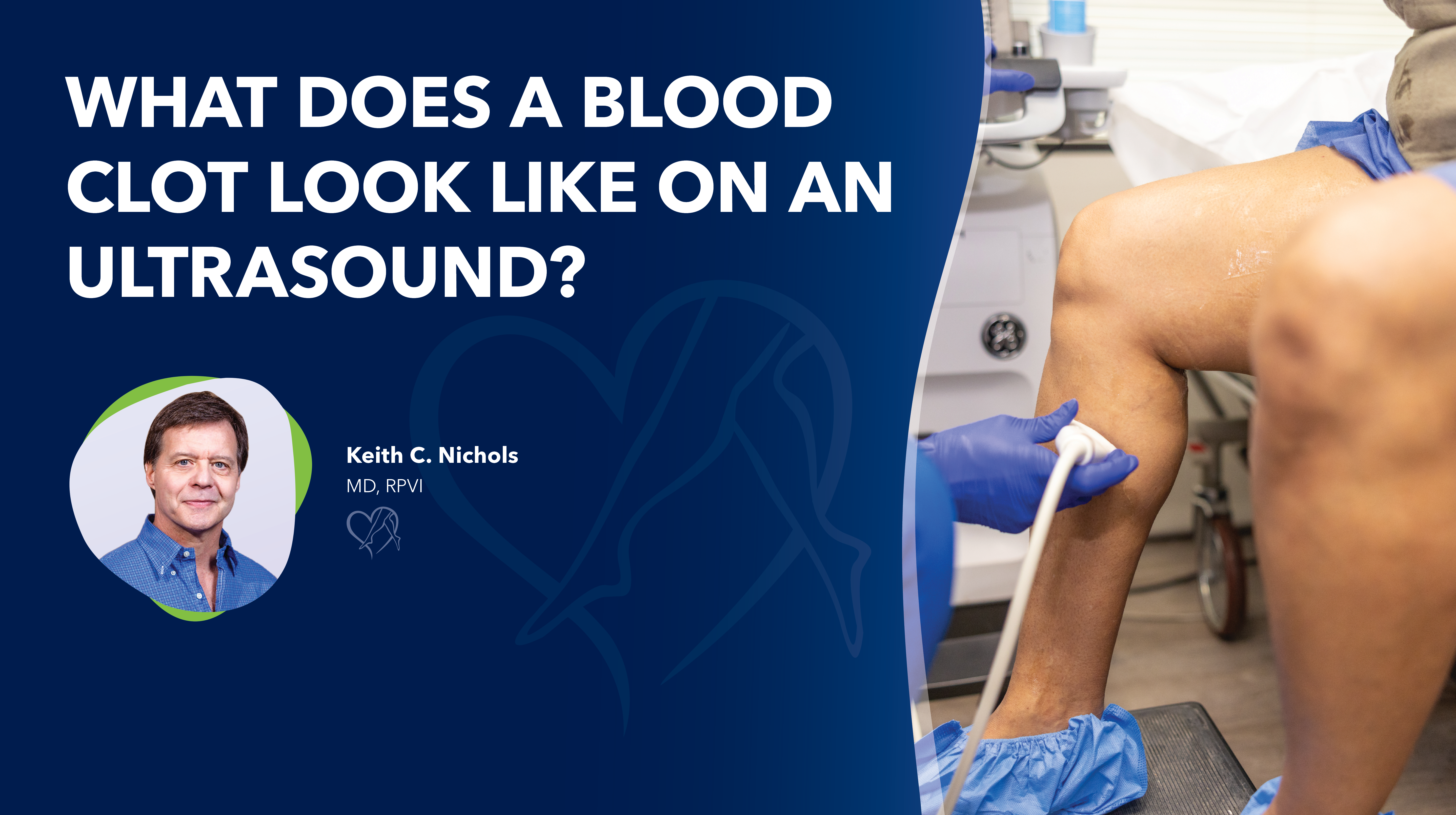 Blog What Does A Blood Clot Look Like Thumbnail