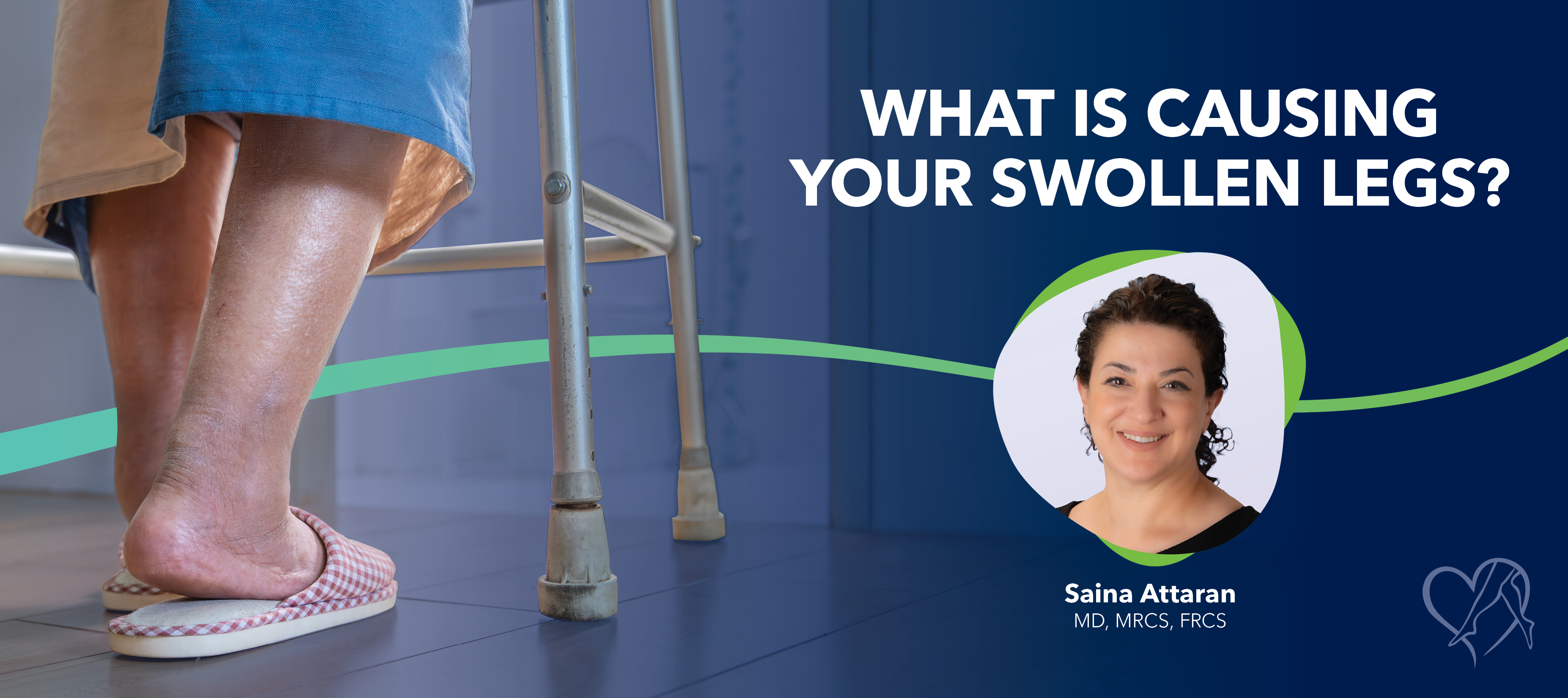 Blog What Is Causing Your Swollen Legs