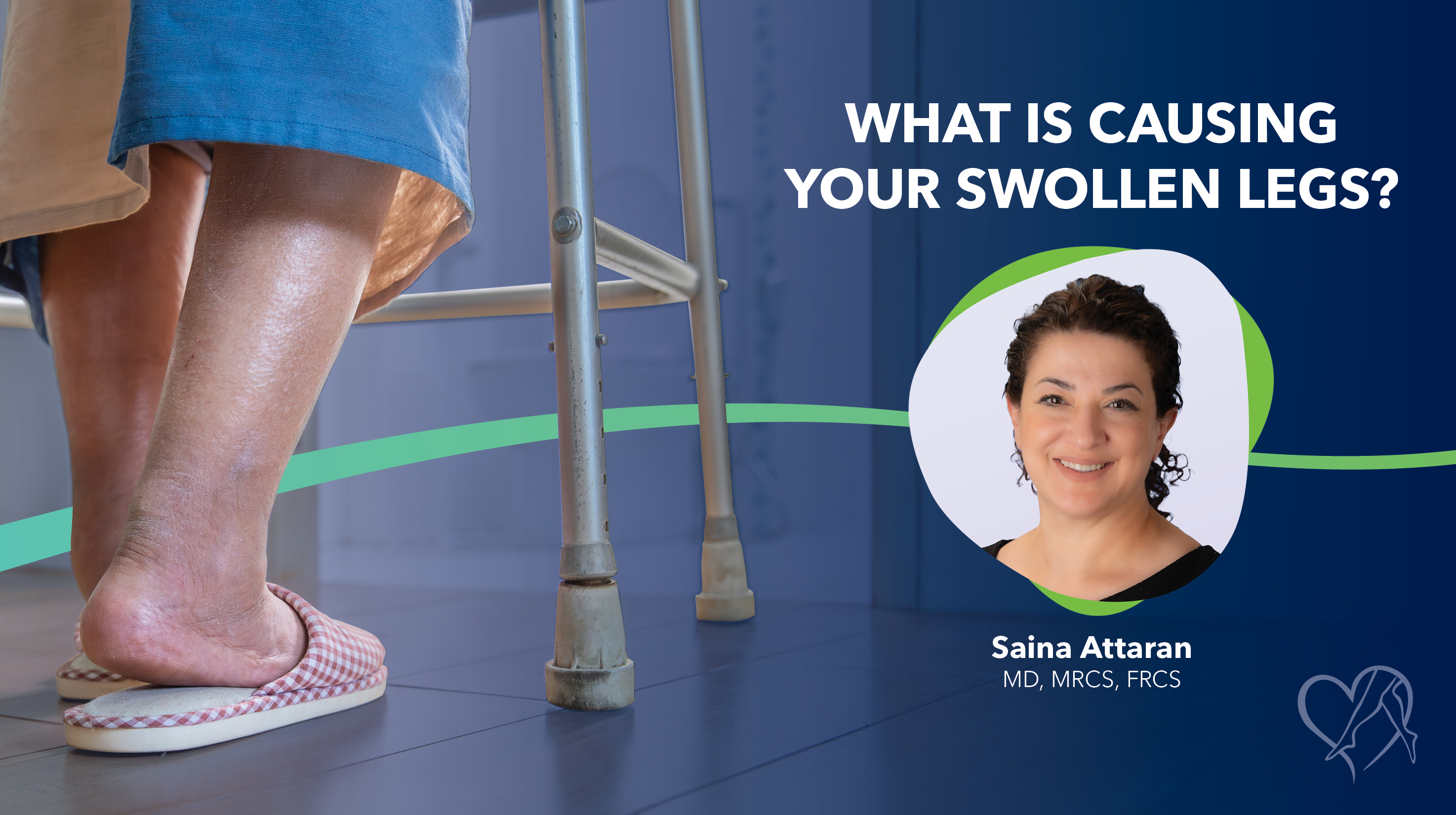 Blog What Is Causing Your Swollen Legs Thumbnail