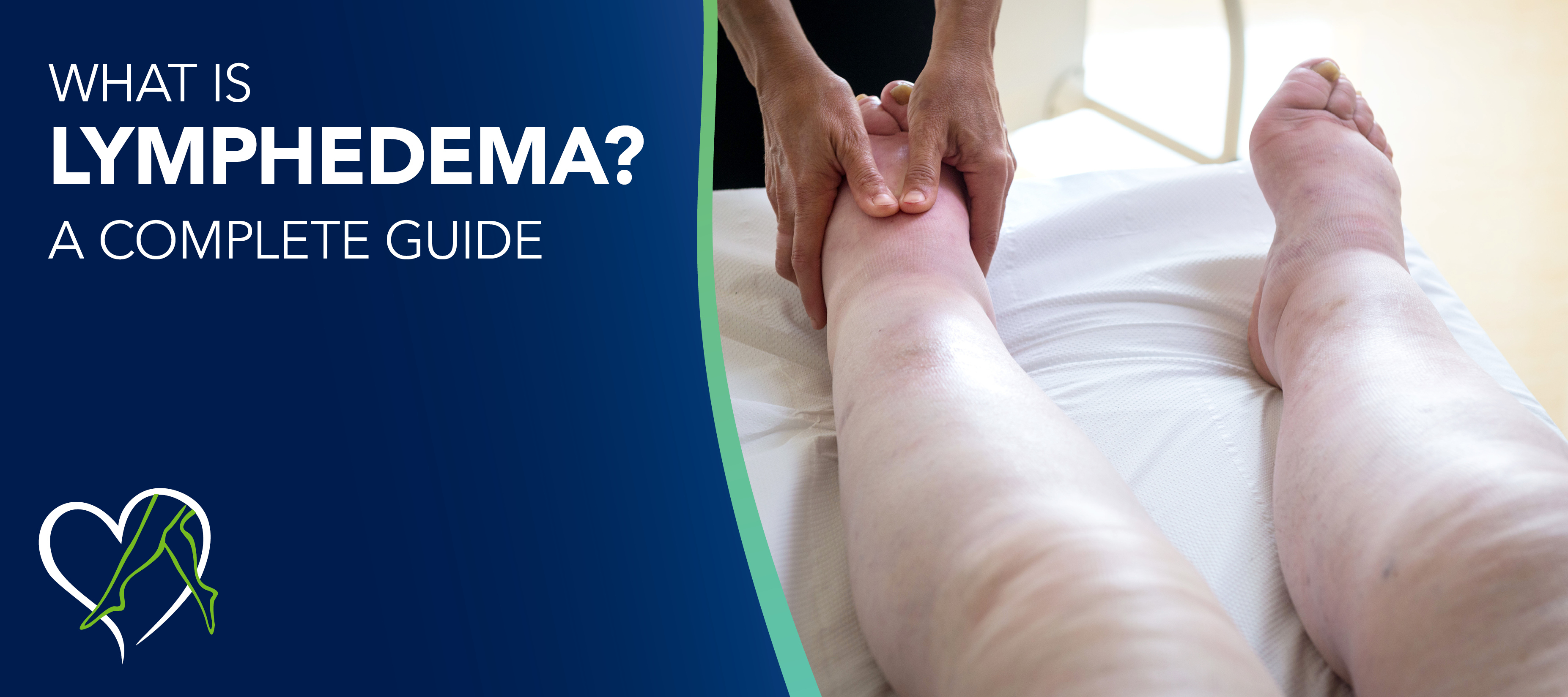Blog What Is Lymphedema