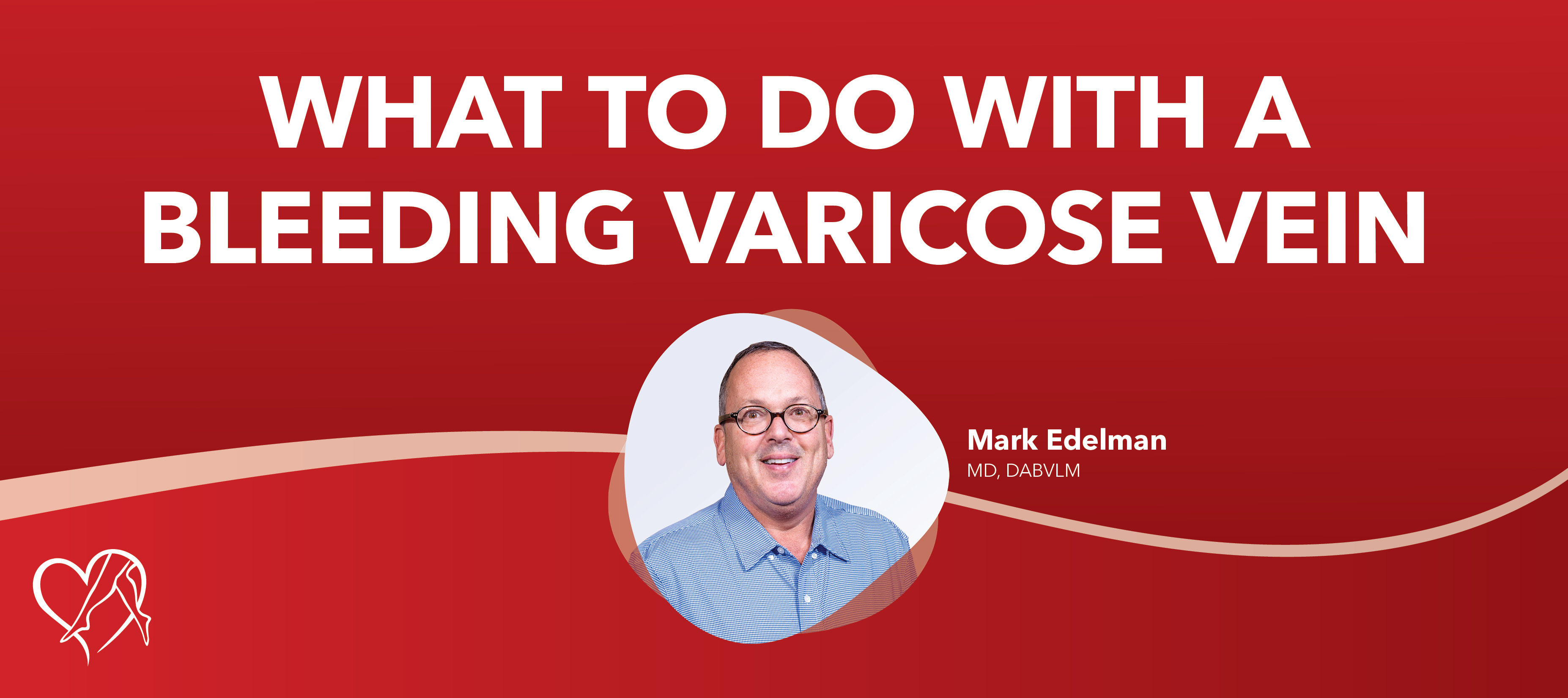 Blog What To Do With A Bleeding Varicose Vein