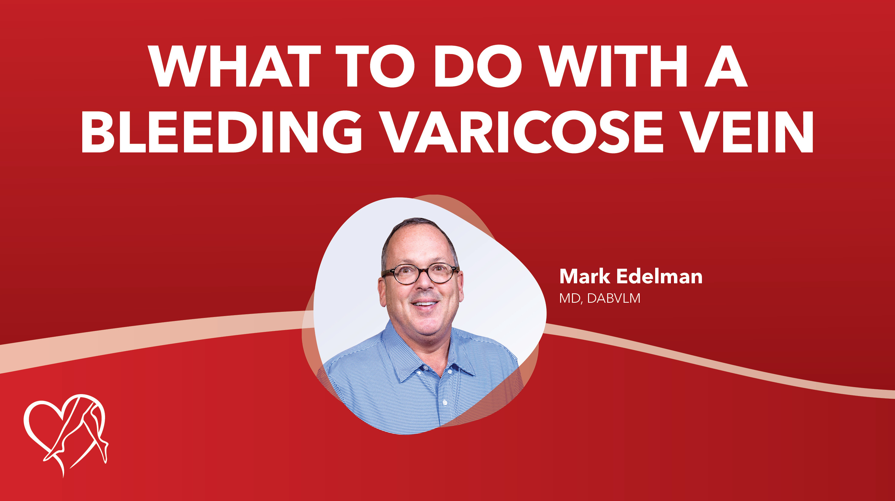 Blog What To Do With A Bleeding Varicose Vein Thumbnail