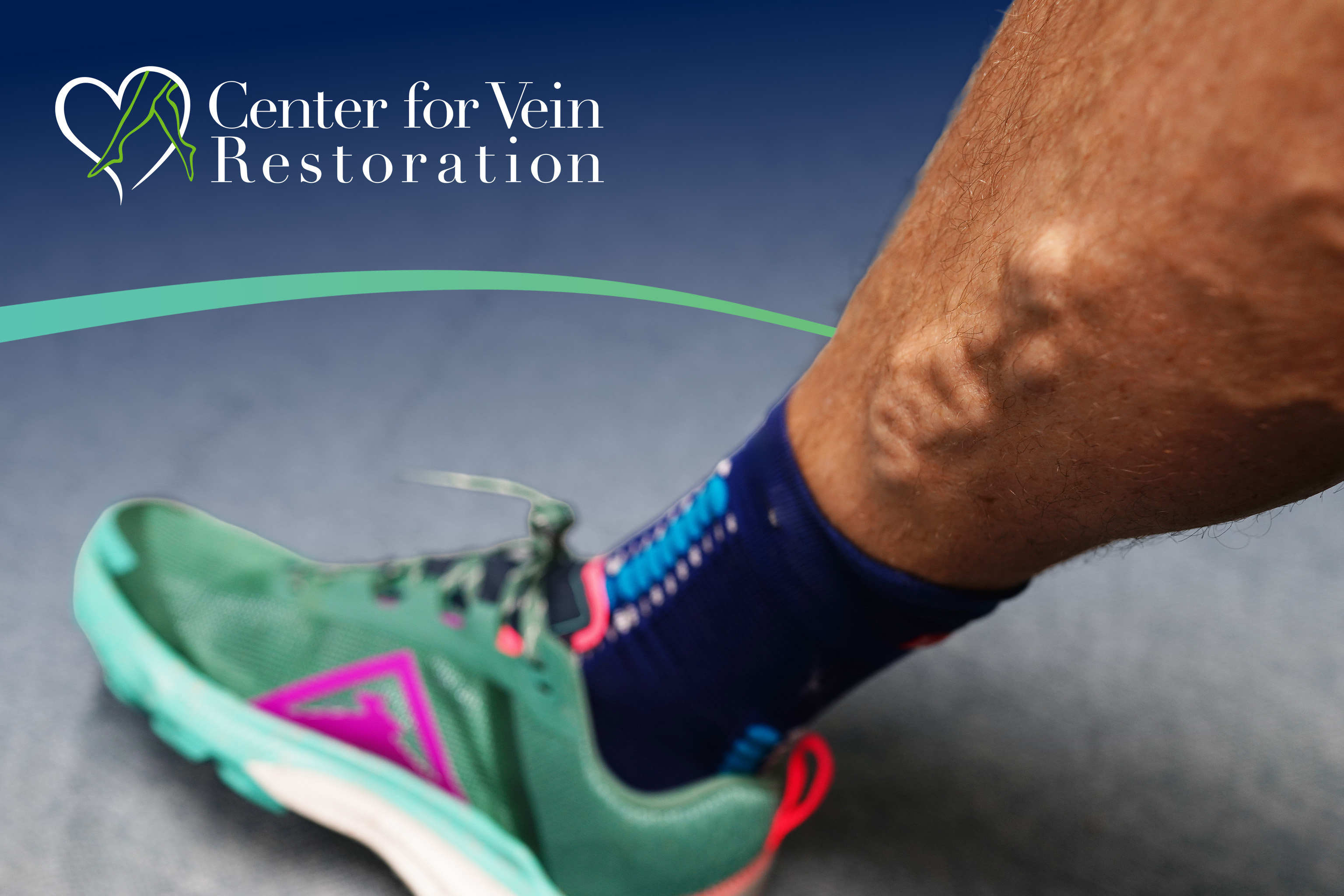 CVR Symptom CEAP2 Bulging New