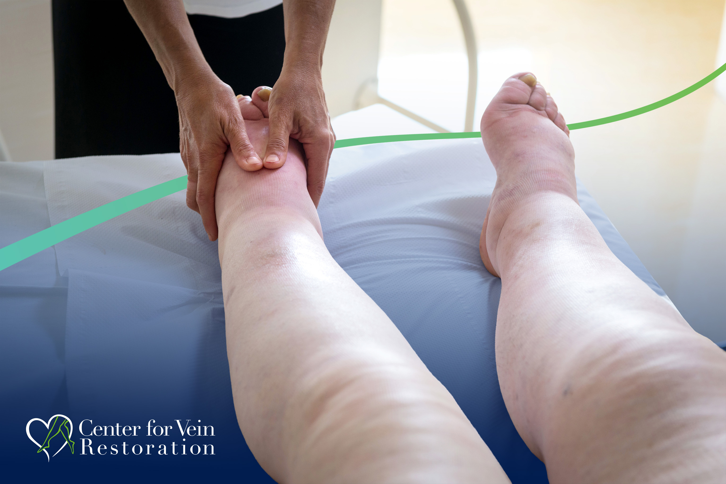 CVR Symptom CEAP3 Lymphedema New