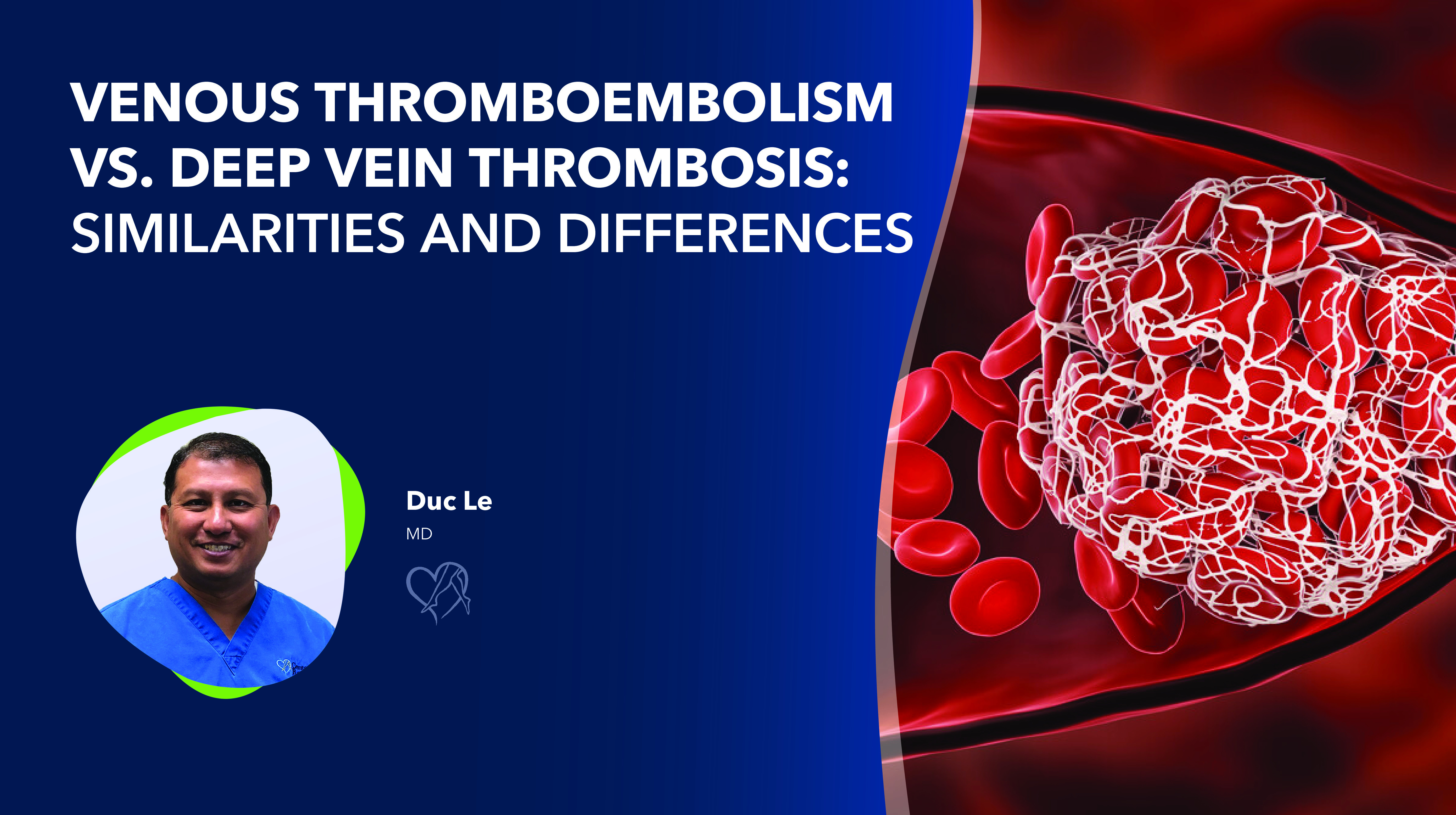 Thumbnail Image How Vein Treatment Gave One Woman Her Life Back Thumbnail