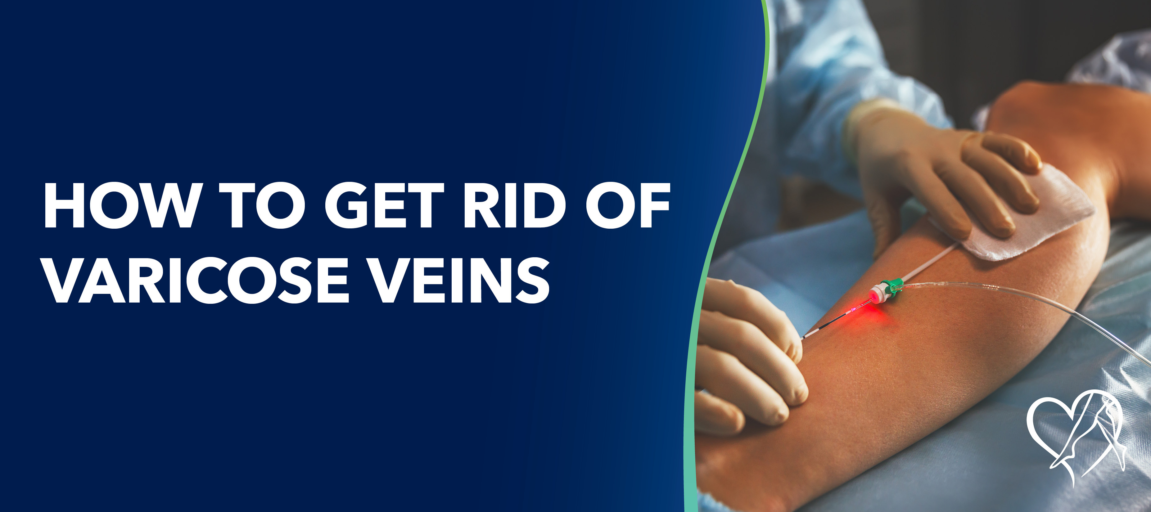 Center for vein restoration How To Get Rid Of Varicose Veins