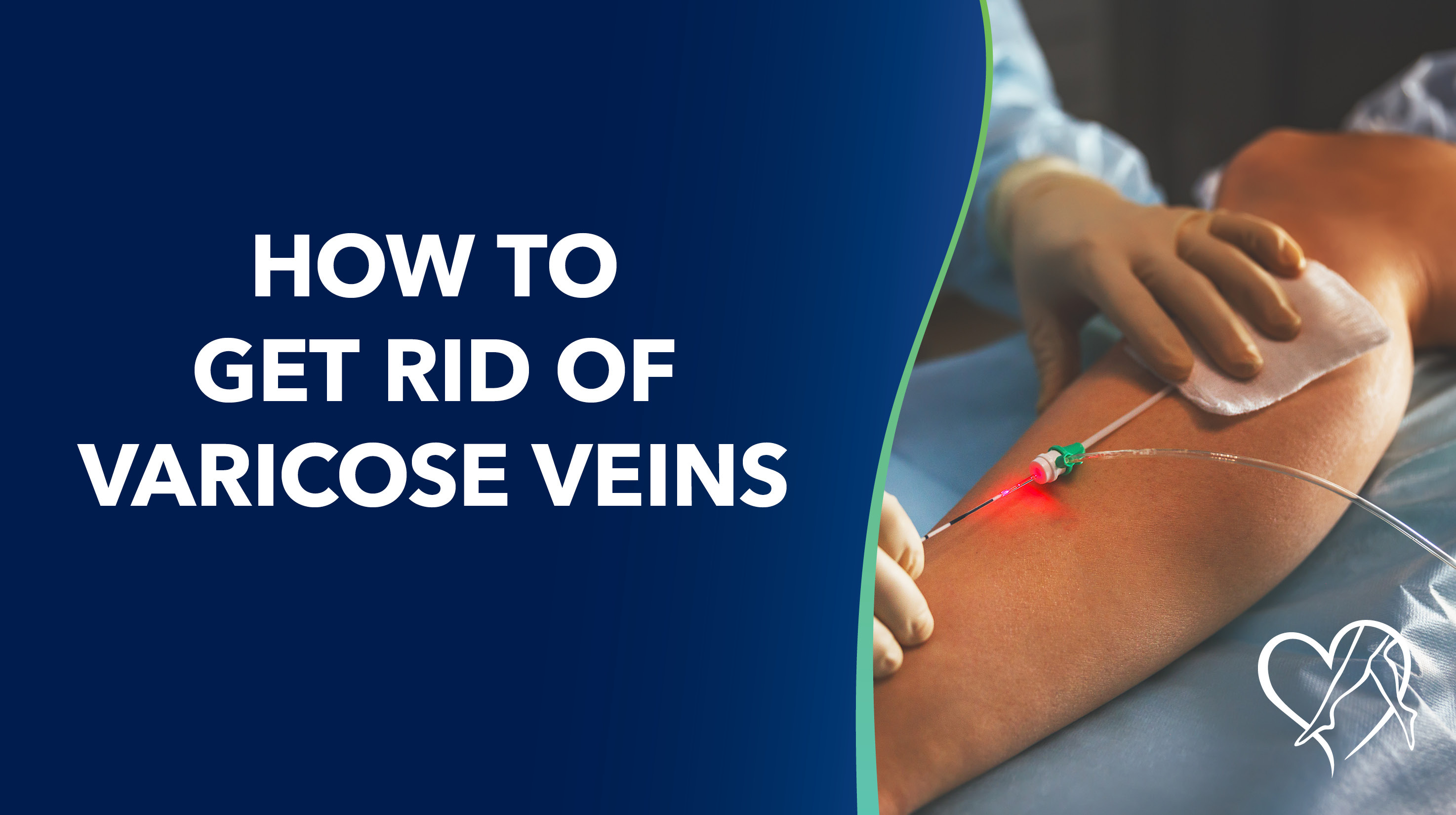 Center for vein restoration How To Get Rid Of Varicose Veins Thumbnail