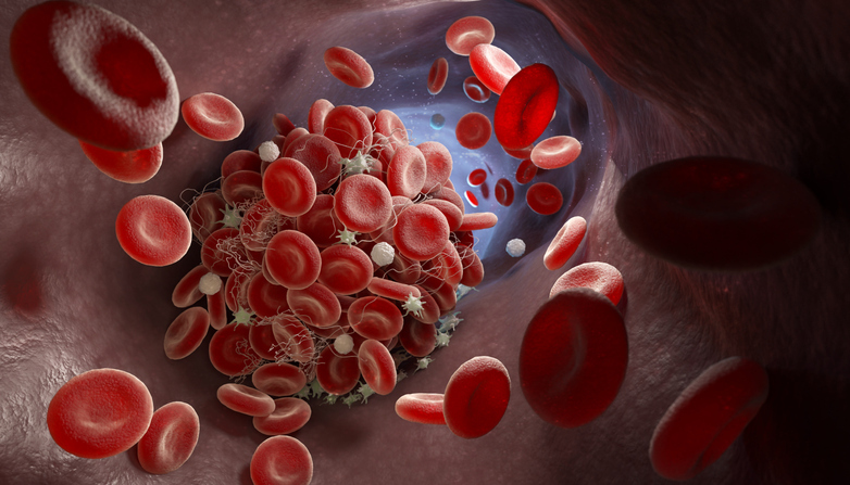 What Does Blood Pooling in the Legs Feel Like?