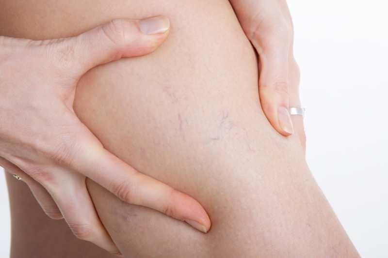 skin pressure massage for vein health