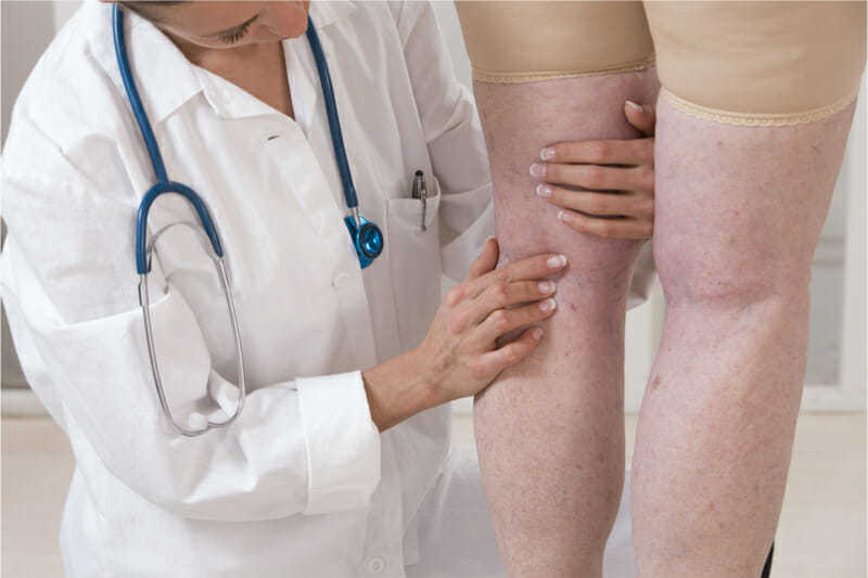 consulta médica para venas