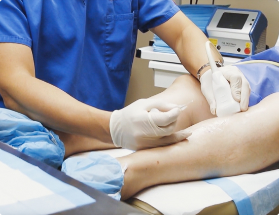 vein Treatment image
