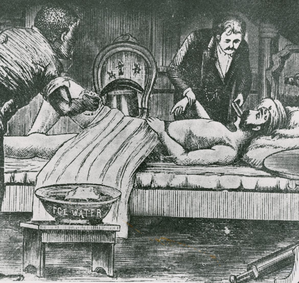 A historical illustration depicts two men performing a surgical procedure on a patient lying on a bed. One man holds a medical tool, while the other assists. A bowl labeled Ice Water is on a nearby table, suggesting use for anesthesia or cooling.