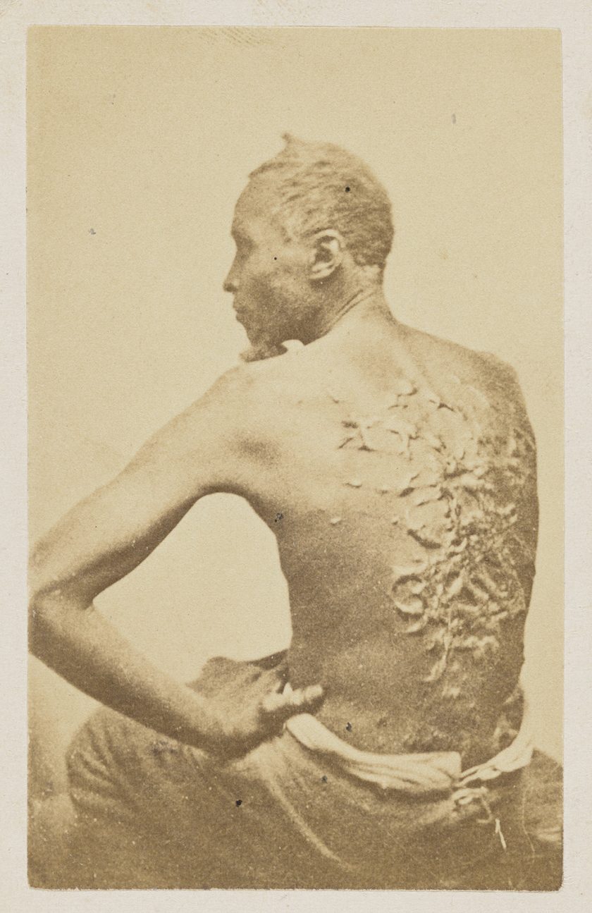 Carte de visite of “The Scourged Back" photograph, 1863