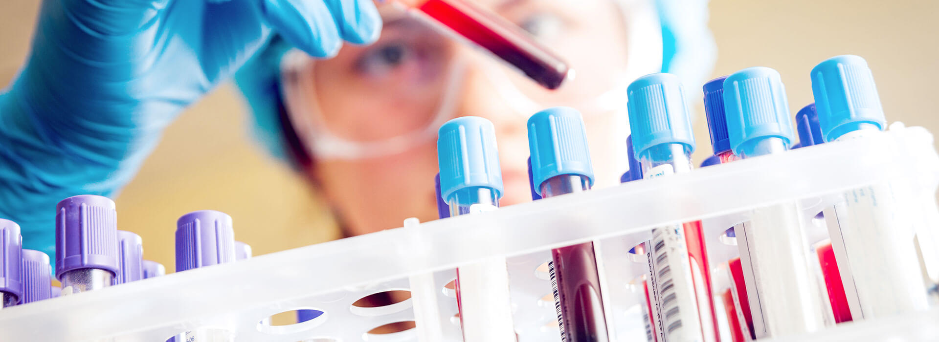 Raffreddamento stampaggio iniezione fiale mediche