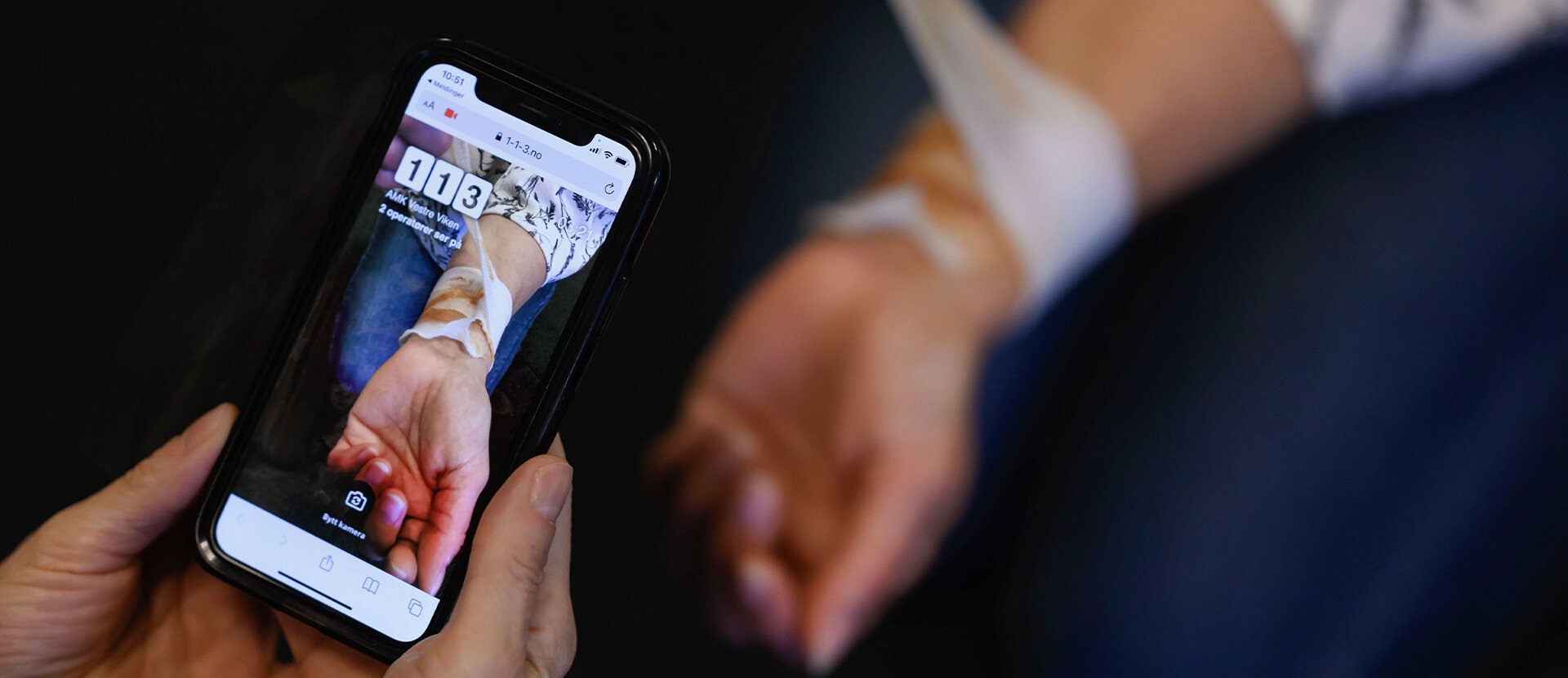 Bildet illustrerer en videosamtale til 113-sentralen. I forgrunnen en mobiltelefon med en bandasjert arm.