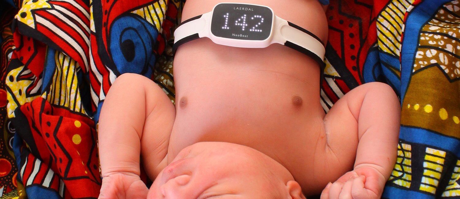 Bildet viser overkroppen til en sovende nyfødt baby som ligger på et fargerikt klede. Rundt brystet er det festet et belte med en monitor som viser tallet 142.