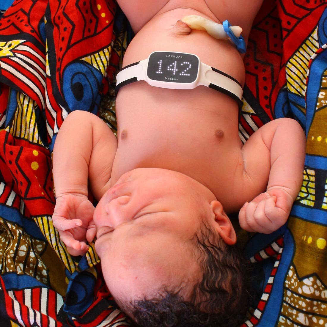 Bildet viser overkroppen til en sovende nyfødt baby som ligger på et fargerikt klede. Rundt brystet er det festet et belte med en monitor som viser tallet 142.