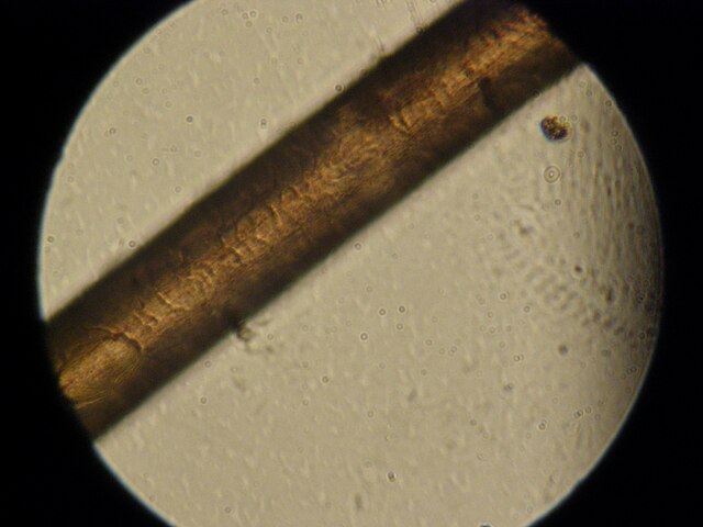 A human black hair surface in light microscope. Parts of the surface layer can be seen
