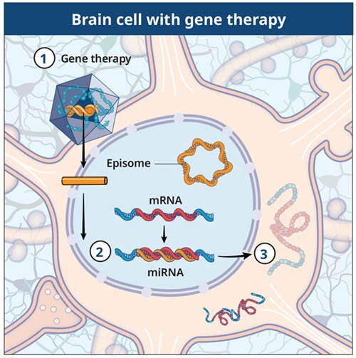 UQ Med Ed In GEN Euity Medicine Brain cell with gene therapy R1