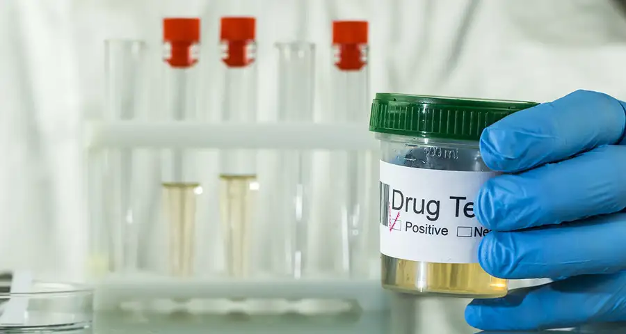 Return to Duty Drug Testing Process | DISA